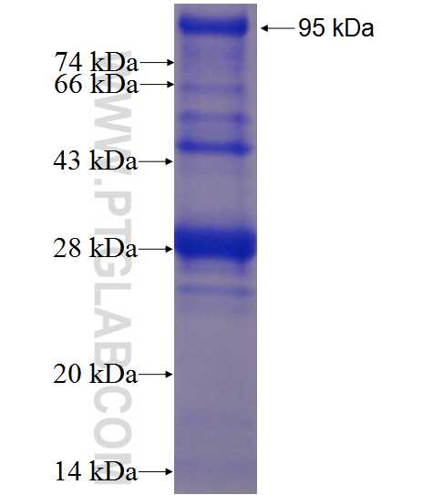 CNGB1 fusion protein Ag22914 SDS-PAGE