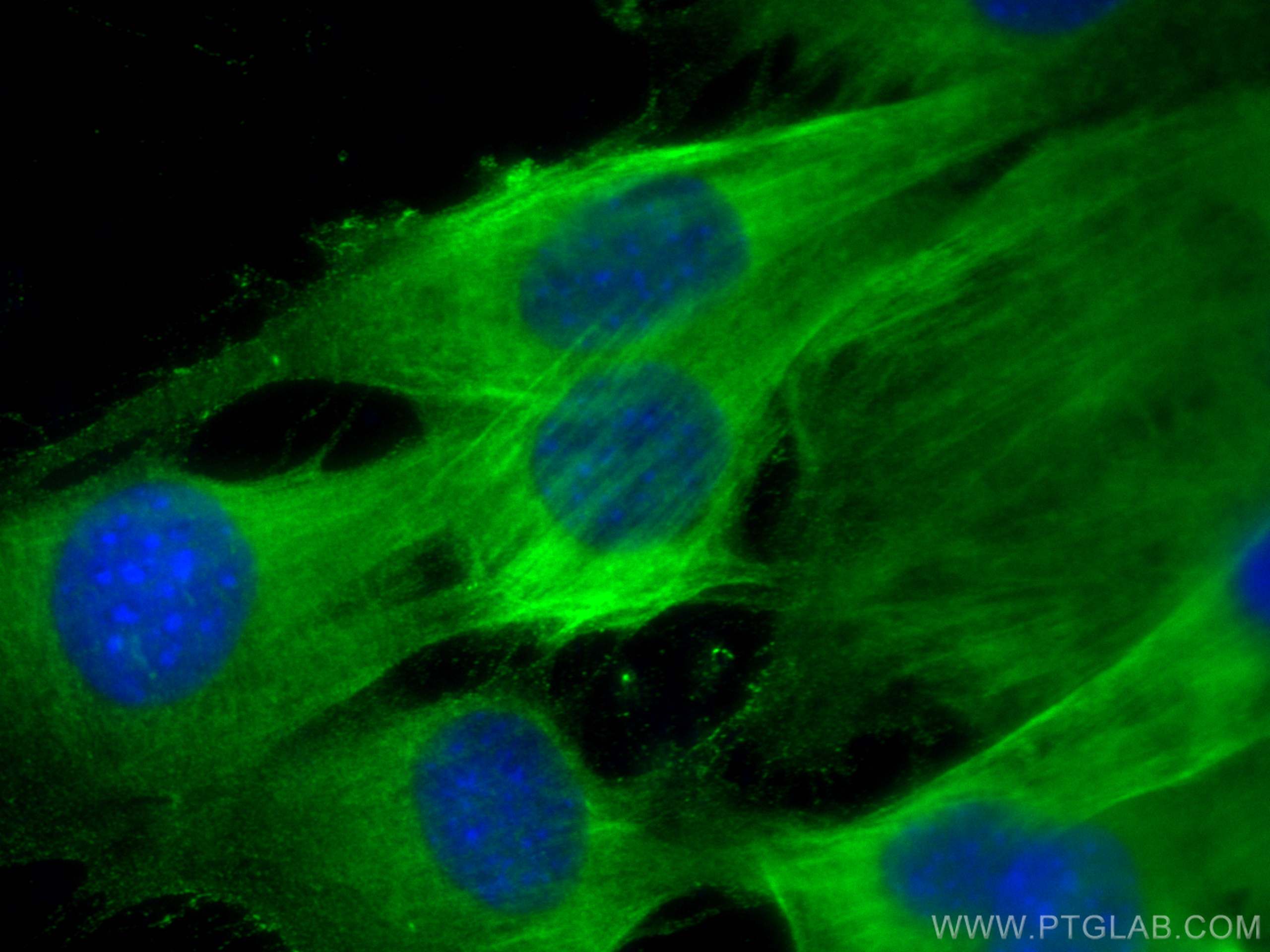Immunofluorescence (IF) / fluorescent staining of C2C12 cells using Calponin Polyclonal antibody (13938-1-AP)