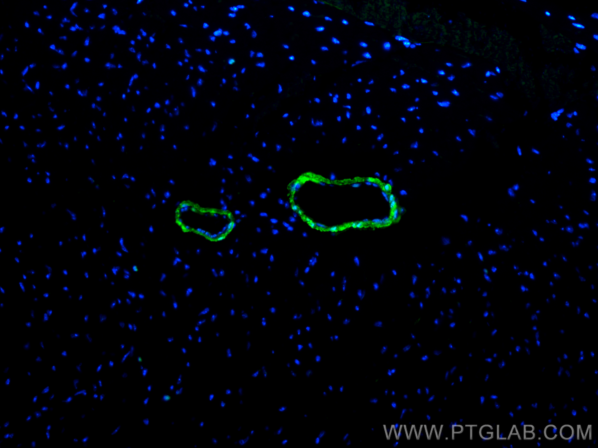 Immunofluorescence (IF) / fluorescent staining of mouse heart tissue using Calponin Polyclonal antibody (13938-1-AP)