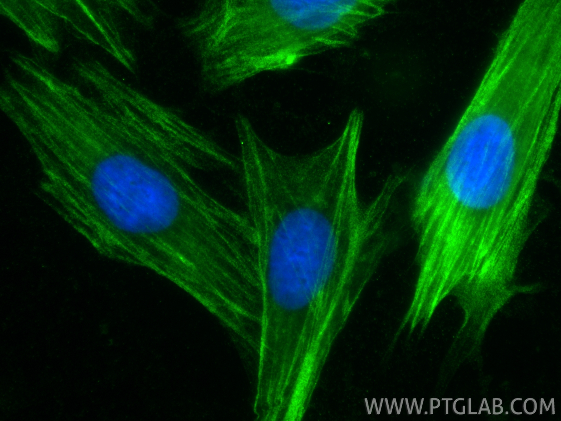 Immunofluorescence (IF) / fluorescent staining of H9C2 cells using Calponin Polyclonal antibody (13938-1-AP)