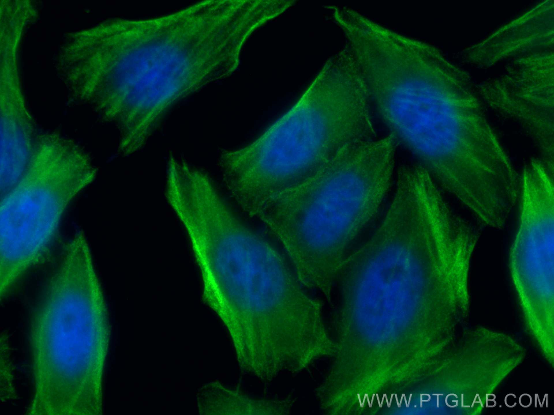 Immunofluorescence (IF) / fluorescent staining of HepG2 cells using CNN2 Polyclonal antibody (21073-1-AP)