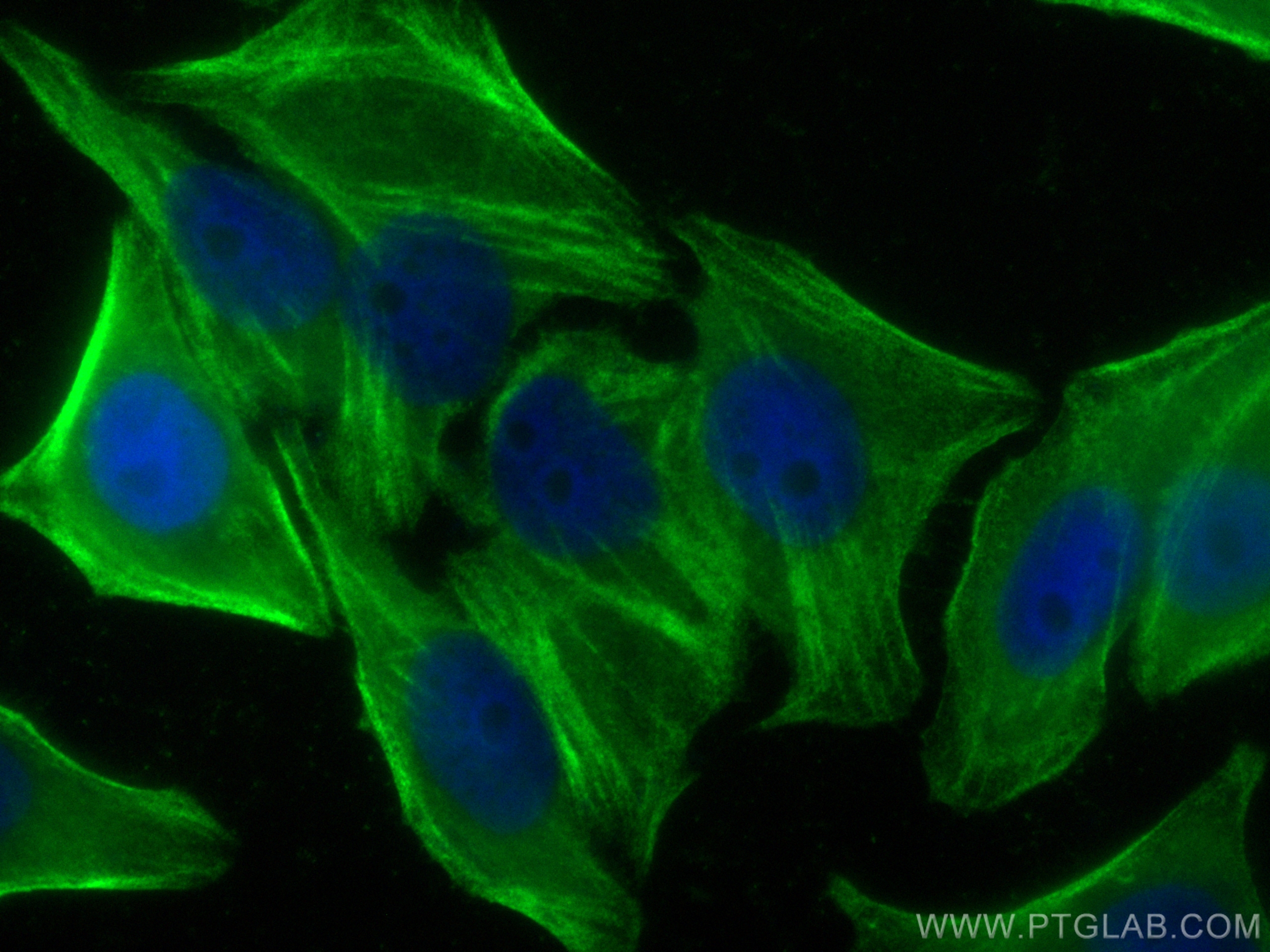 Immunofluorescence (IF) / fluorescent staining of HepG2 cells using CoraLite® Plus 488-conjugated CNN2 Polyclonal anti (CL488-21073)