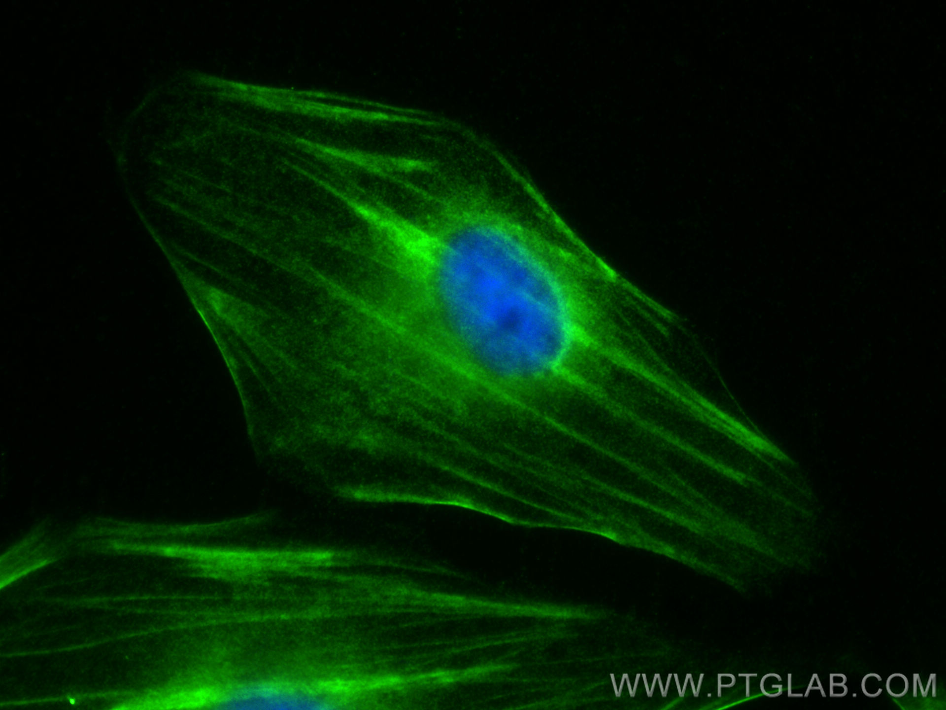 Immunofluorescence (IF) / fluorescent staining of HeLa cells using CNN3 Polyclonal antibody (11509-1-AP)