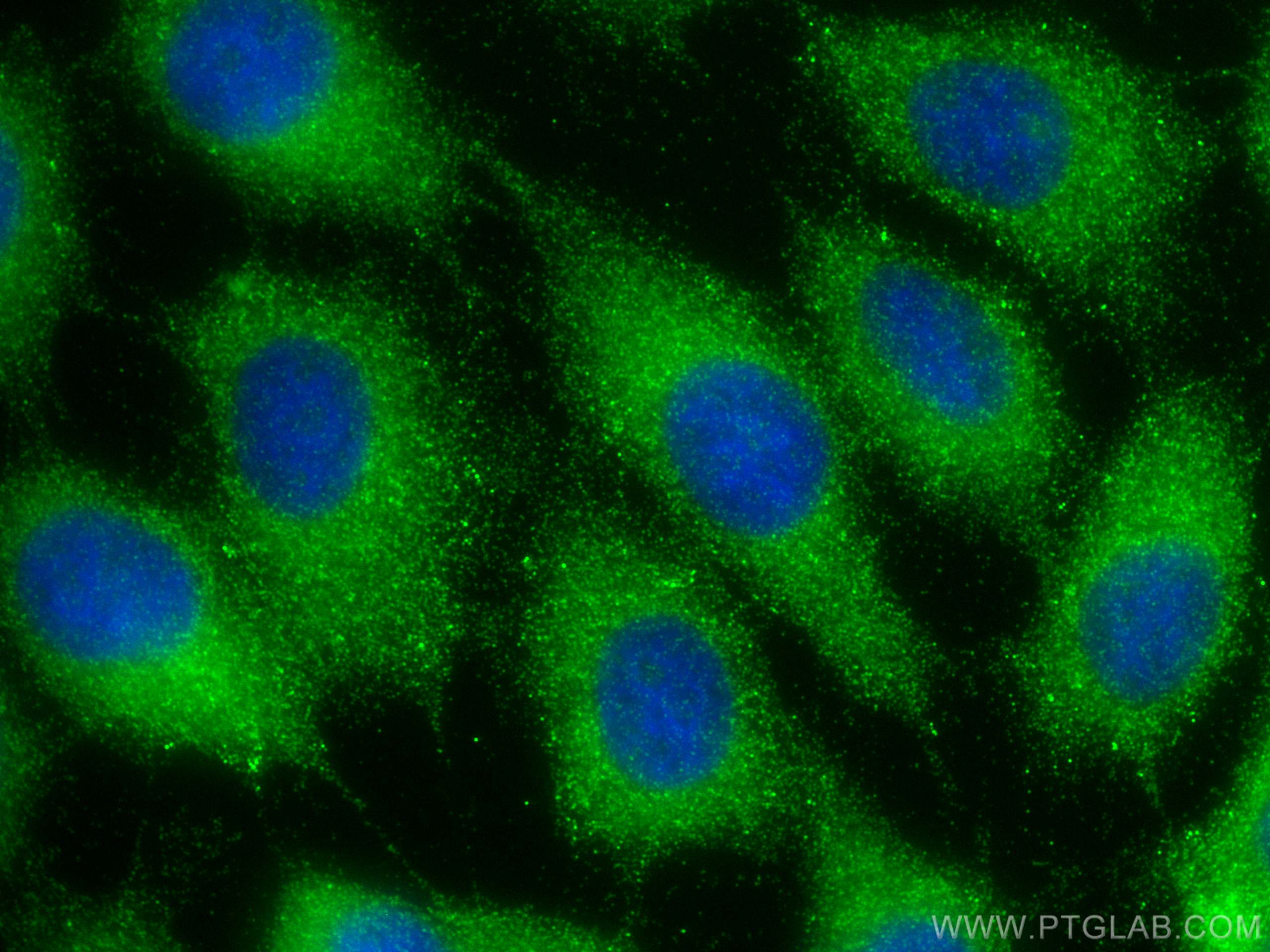 Immunofluorescence (IF) / fluorescent staining of A431 cells using CNNM3 Polyclonal antibody (13976-1-AP)