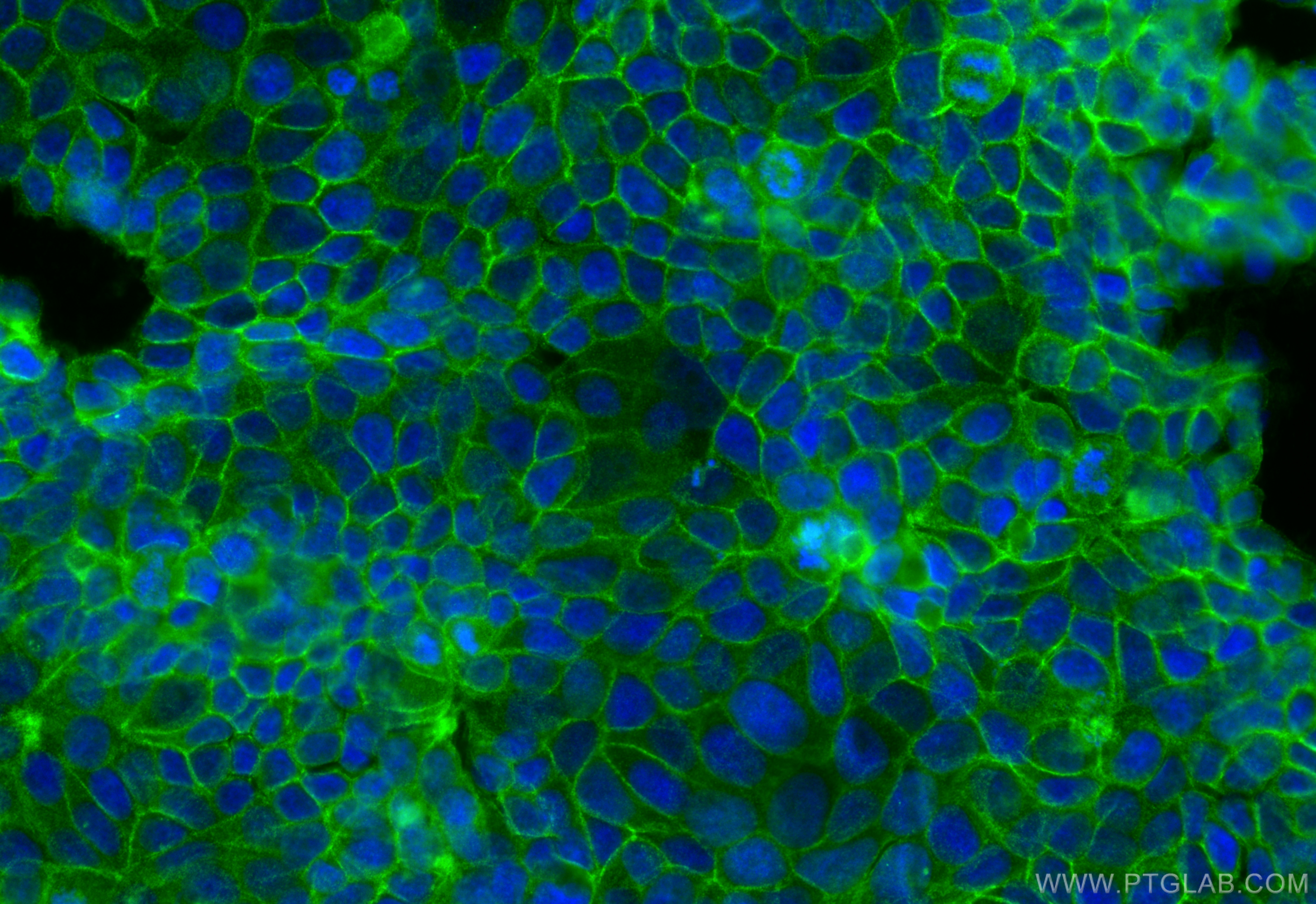 Immunofluorescence (IF) / fluorescent staining of MCF-7 cells using CNNM4 Polyclonal antibody (14066-1-AP)