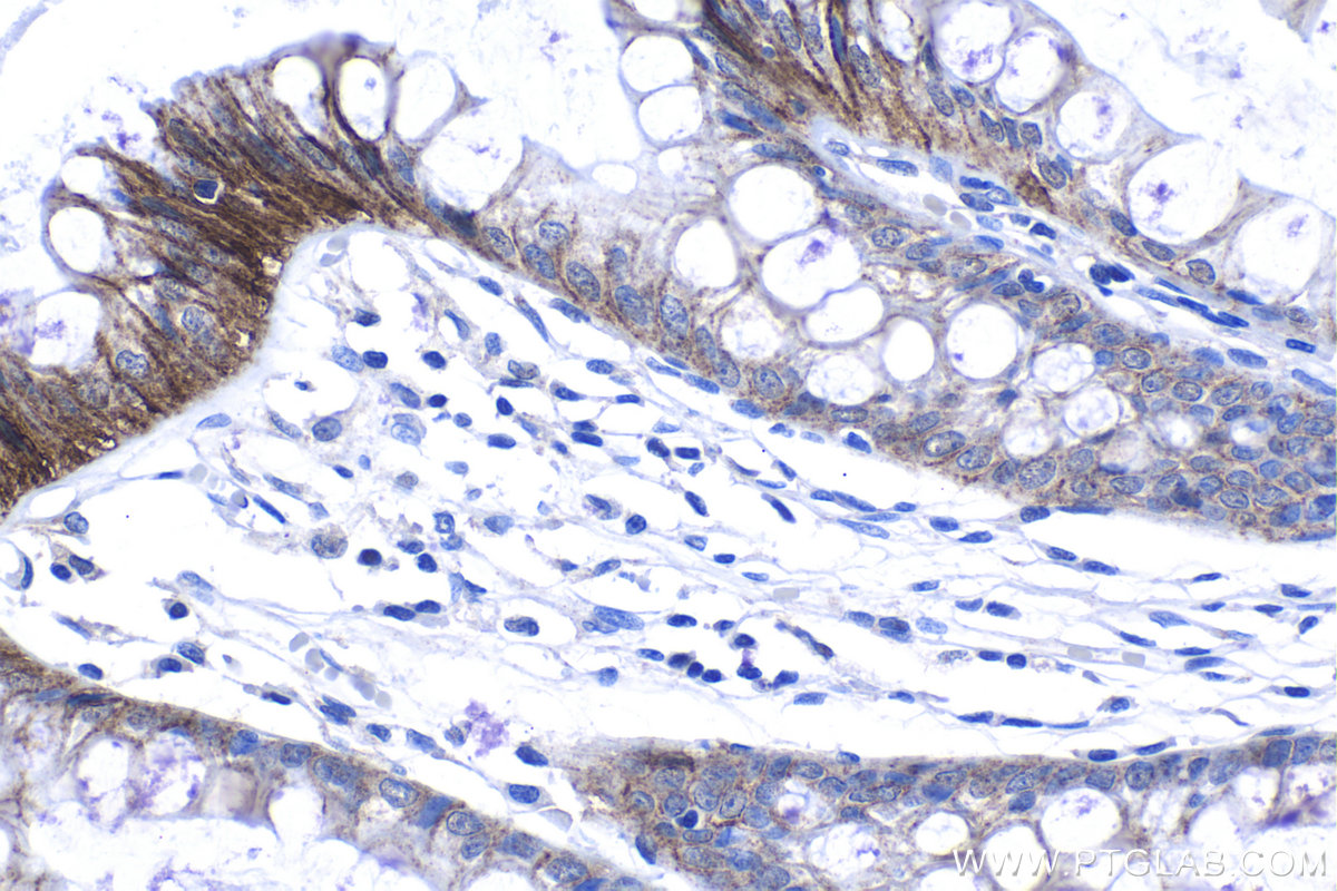 Immunohistochemistry (IHC) staining of human colon tissue using CNNM4 Polyclonal antibody (14066-1-AP)