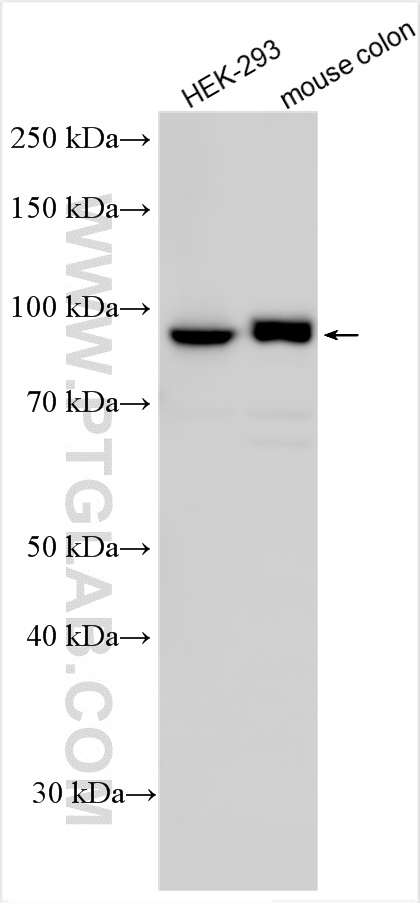 Western Blot (WB) analysis of various lysates using CNNM4 Polyclonal antibody (14066-1-AP)