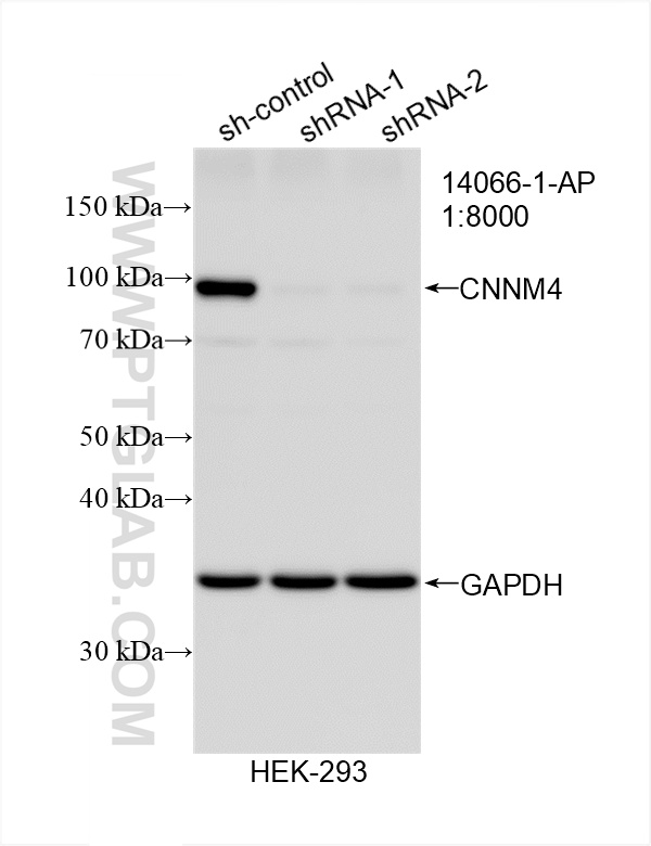 Western Blot (WB) analysis of HEK-293 cells using CNNM4 Polyclonal antibody (14066-1-AP)