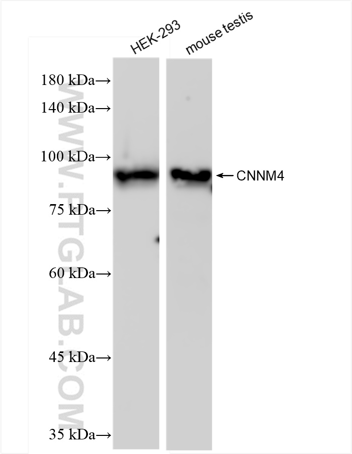 Western Blot (WB) analysis of various lysates using CNNM4 Recombinant antibody (83824-4-RR)