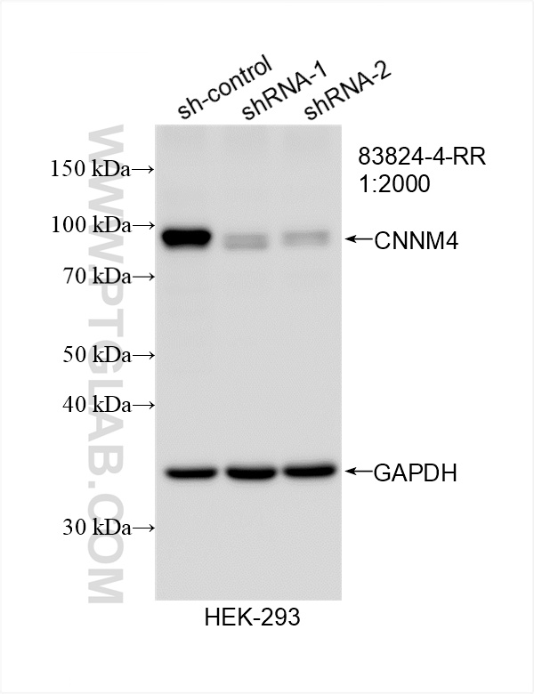 Western Blot (WB) analysis of HEK-293 cells using CNNM4 Recombinant antibody (83824-4-RR)