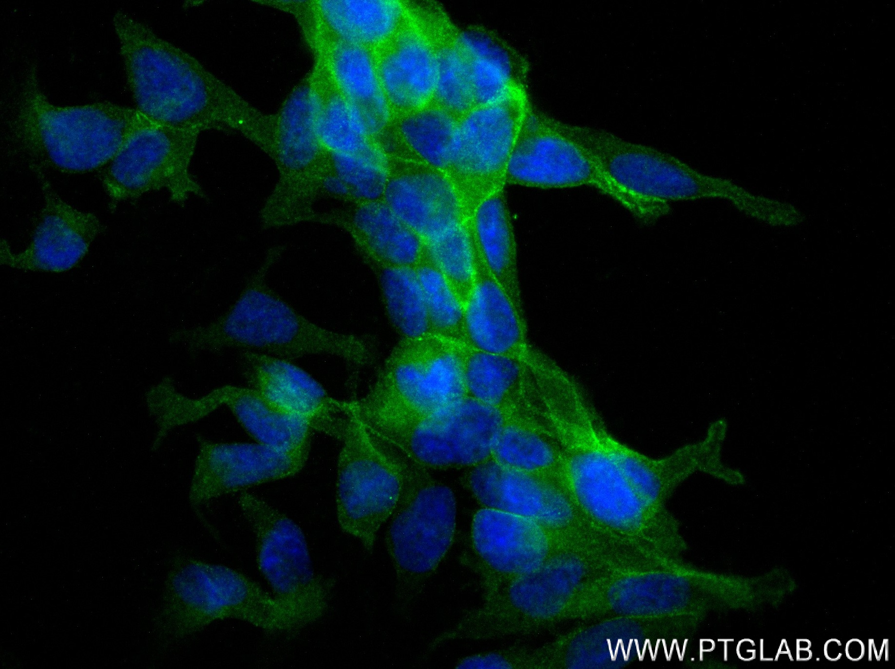 Immunofluorescence (IF) / fluorescent staining of LNCaP cells using CNNM4 Recombinant antibody (83824-5-RR)