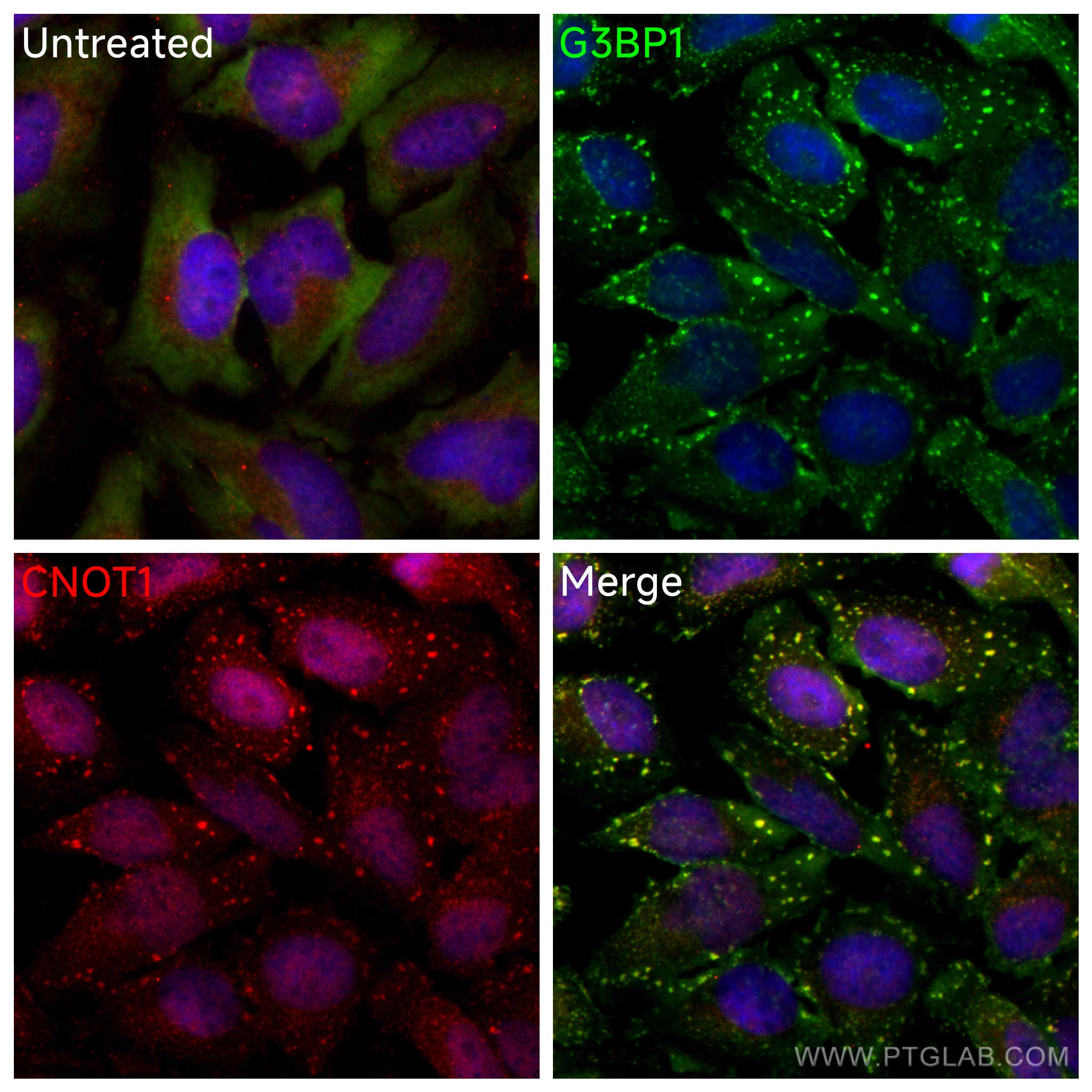 Immunofluorescence (IF) / fluorescent staining of HeLa cells using CNOT1 Polyclonal antibody (14276-1-AP)