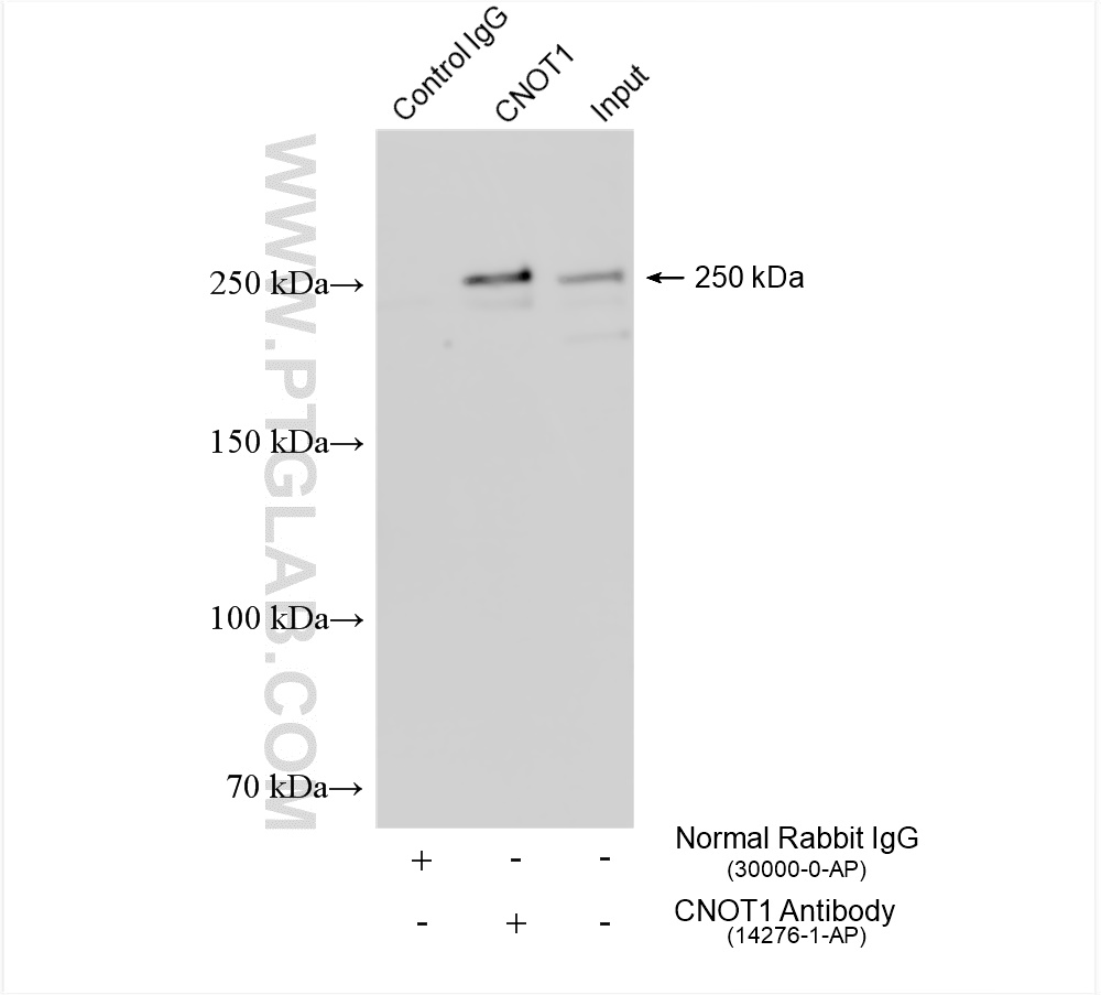 Immunoprecipitation (IP) experiment of HeLa cells using CNOT1 Polyclonal antibody (14276-1-AP)