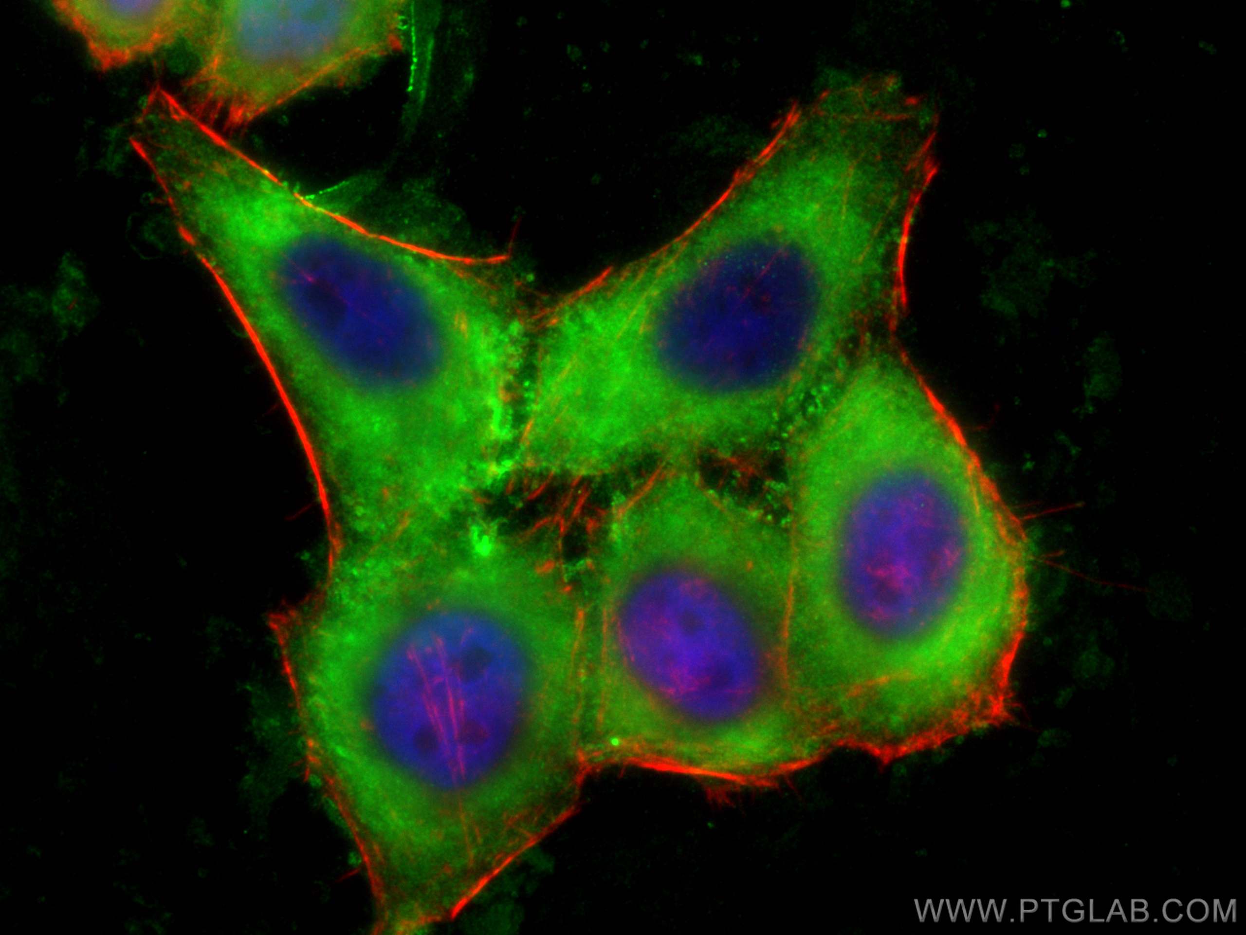 Immunofluorescence (IF) / fluorescent staining of HepG2 cells using CNOT10 Polyclonal antibody (15938-1-AP)