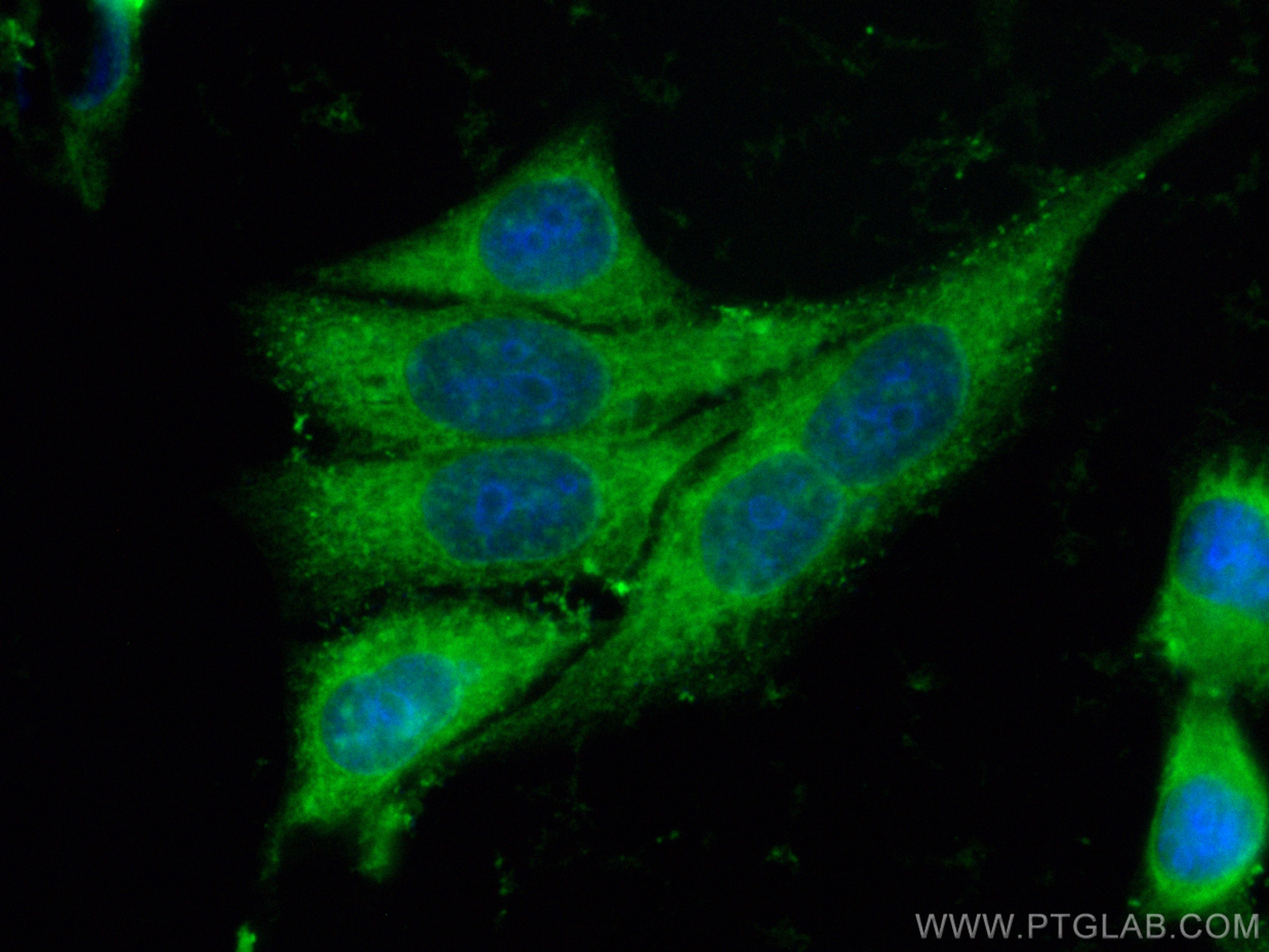 Immunofluorescence (IF) / fluorescent staining of HepG2 cells using CoraLite® Plus 488-conjugated CNOT10 Polyclonal an (CL488-15938)