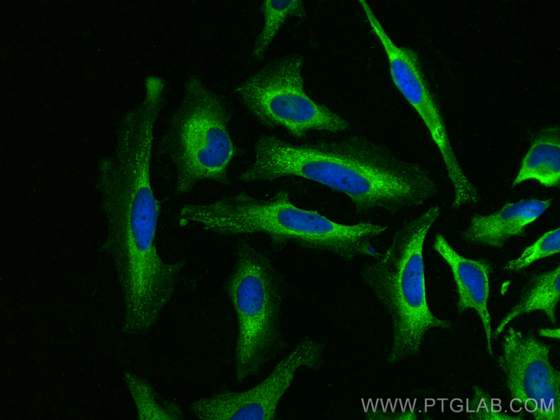 Immunofluorescence (IF) / fluorescent staining of HeLa cells using CNOT3 Polyclonal antibody (11135-1-AP)