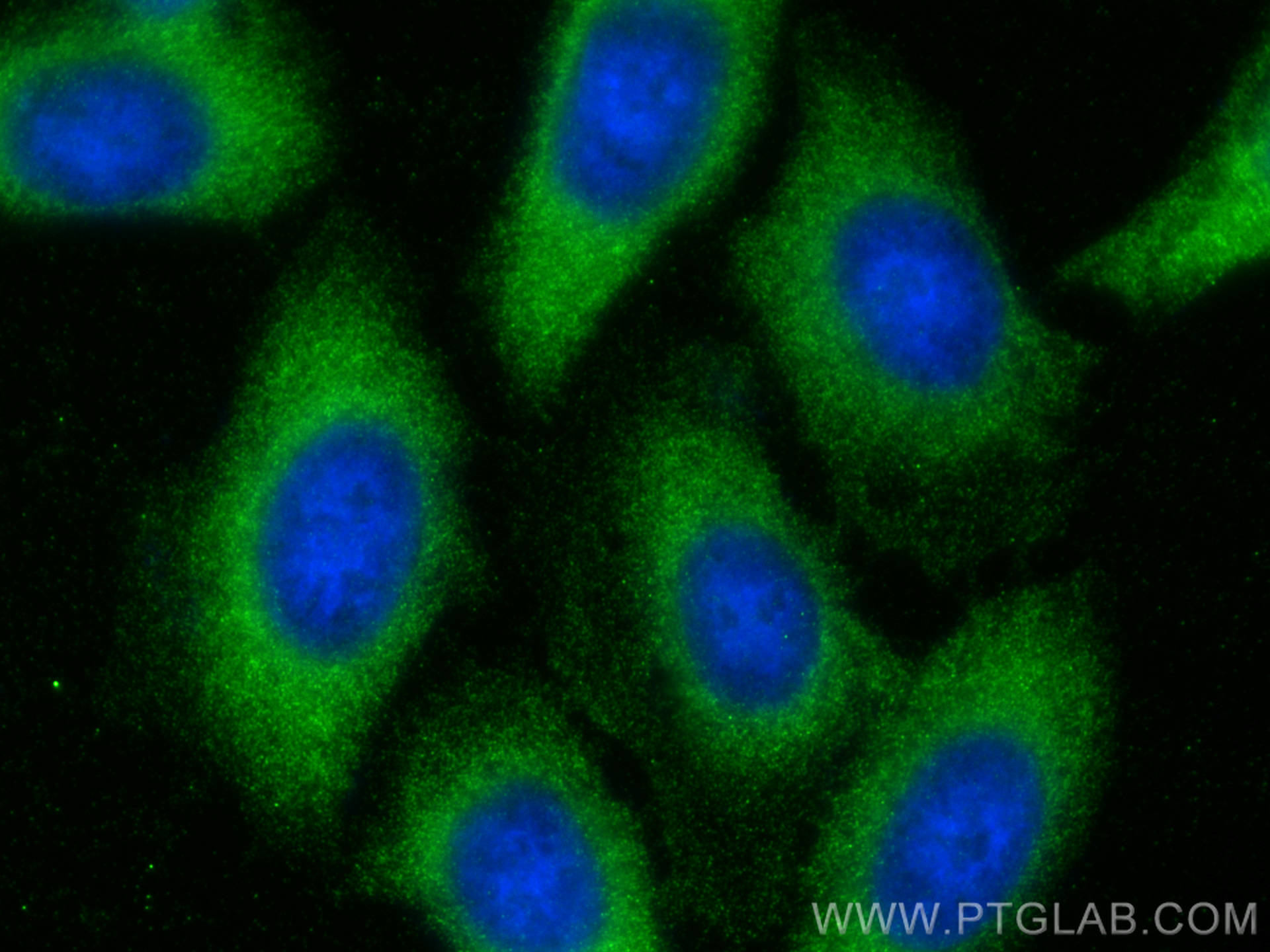 Immunofluorescence (IF) / fluorescent staining of HepG2 cells using CNOT4 Monoclonal antibody (67798-1-Ig)