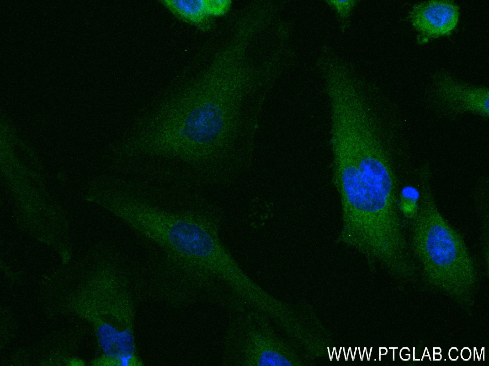 Immunofluorescence (IF) / fluorescent staining of HeLa cells using CNOT4 Recombinant antibody (83615-4-RR)