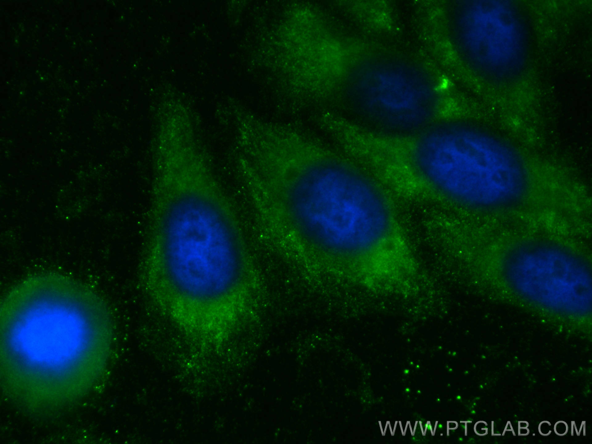 Immunofluorescence (IF) / fluorescent staining of HepG2 cells using CoraLite® Plus 488-conjugated CNOT4 Monoclonal ant (CL488-67798)