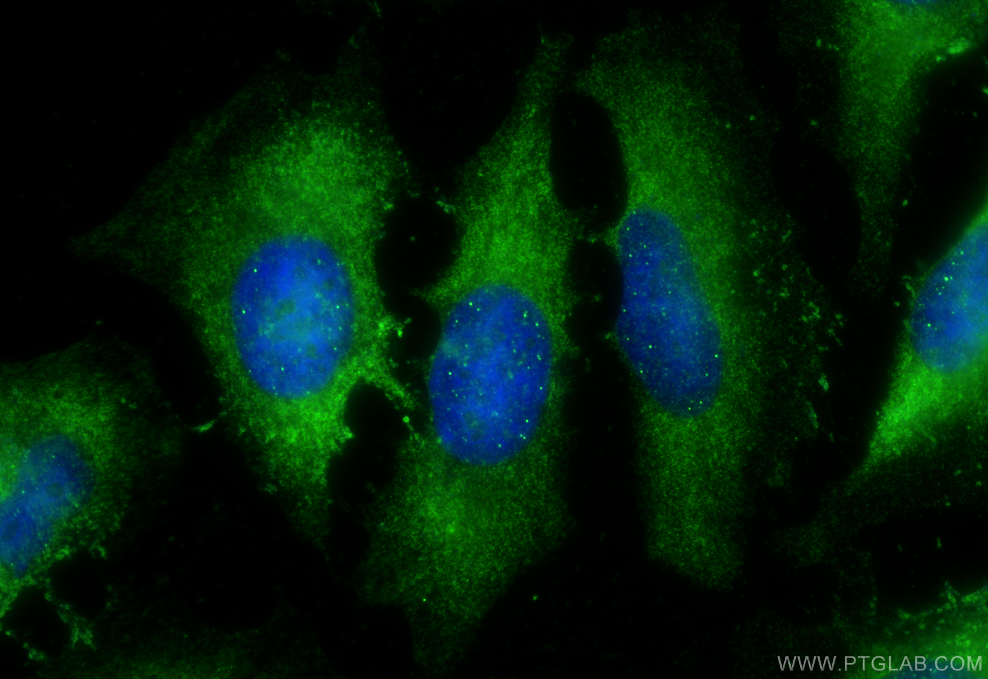 Immunofluorescence (IF) / fluorescent staining of HeLa cells using CNOT8 Polyclonal antibody (10752-1-AP)