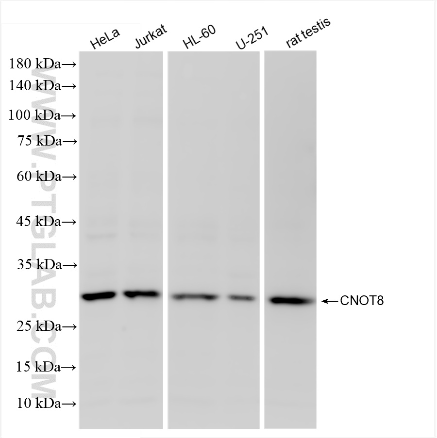 Western Blot (WB) analysis of various lysates using CNOT8 Recombinant antibody (86091-1-RR)