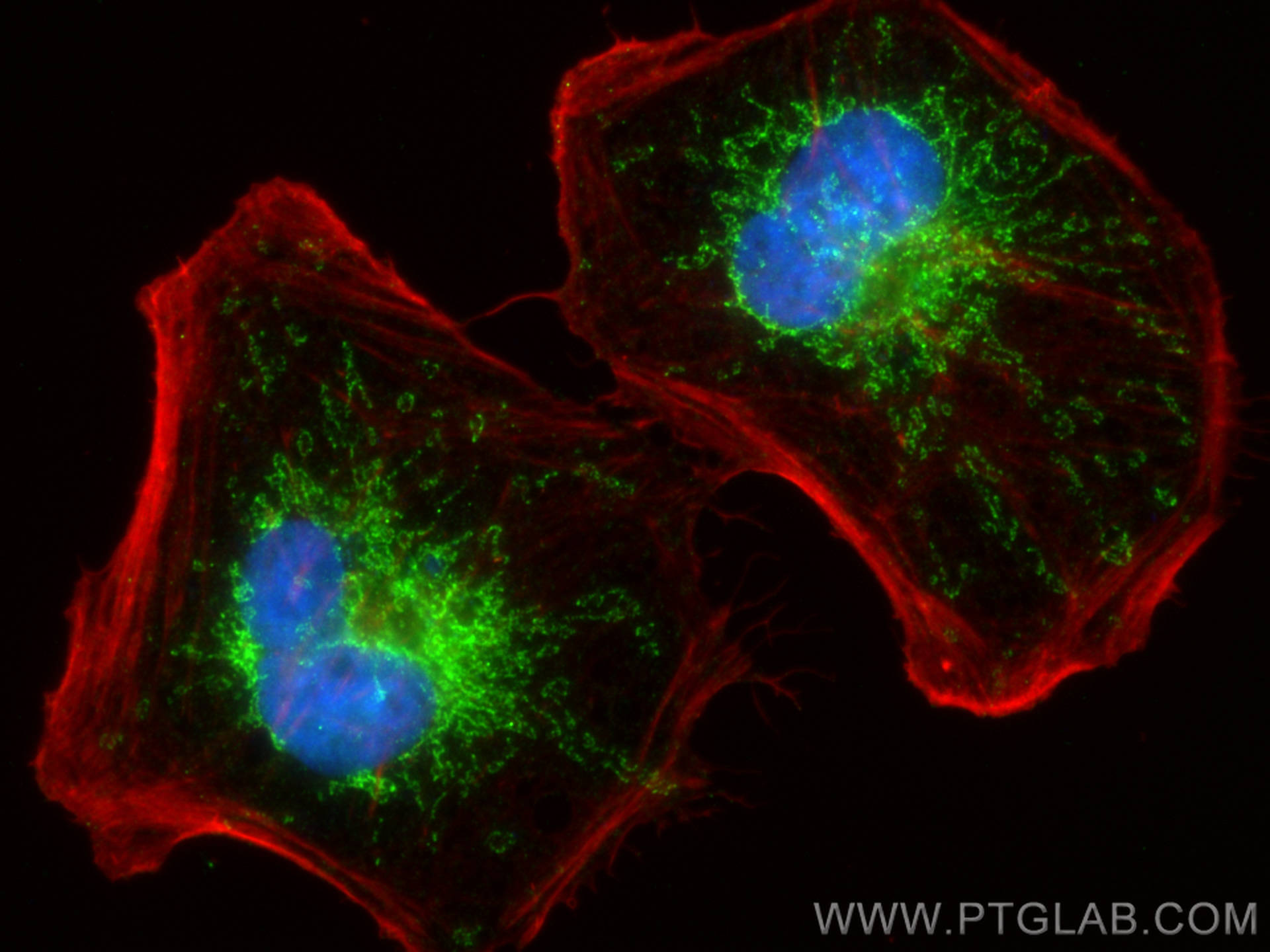 Immunofluorescence (IF) / fluorescent staining of HeLa cells using COA1 Polyclonal antibody (25197-1-AP)