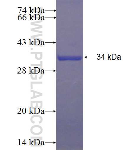 COBL fusion protein Ag23570 SDS-PAGE