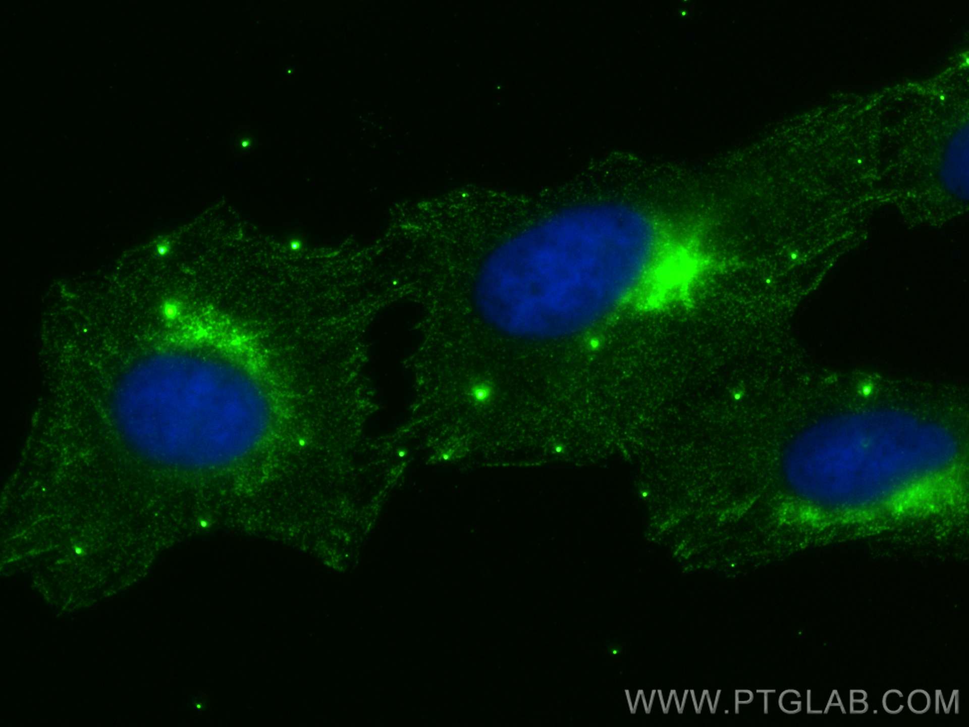 Immunofluorescence (IF) / fluorescent staining of U2OS cells using COG1 Monoclonal antibody (68642-1-Ig)