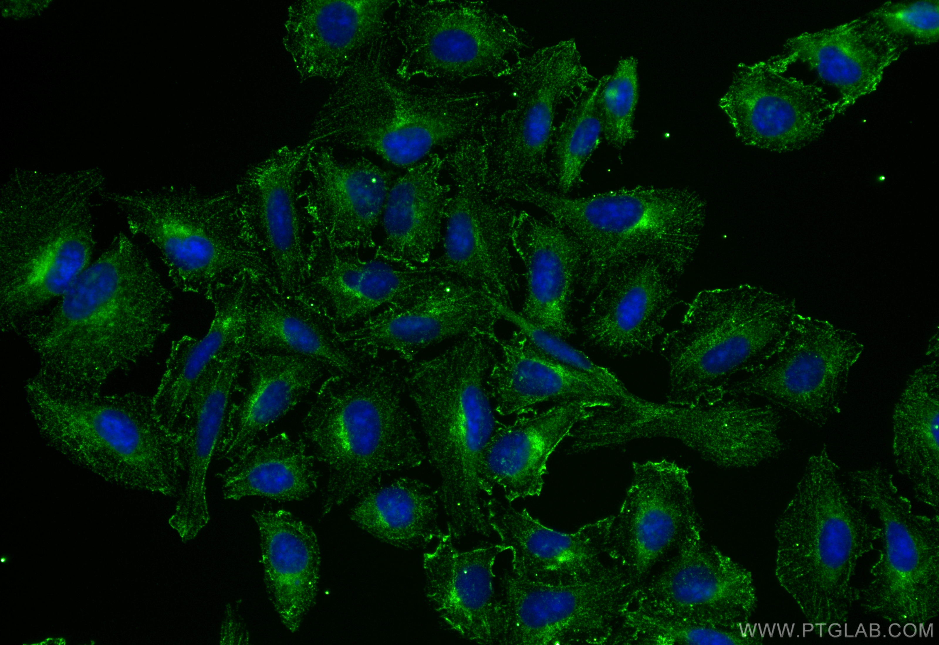 Immunofluorescence (IF) / fluorescent staining of U2OS cells using COG1 Monoclonal antibody (68642-1-Ig)