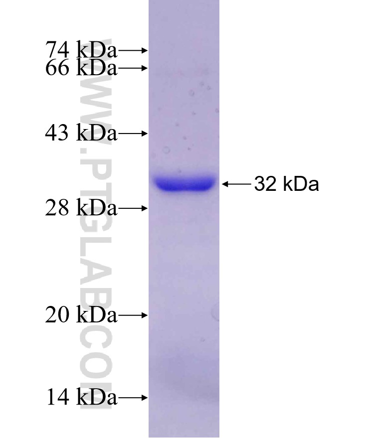 COL10A1 fusion protein Ag29739 SDS-PAGE