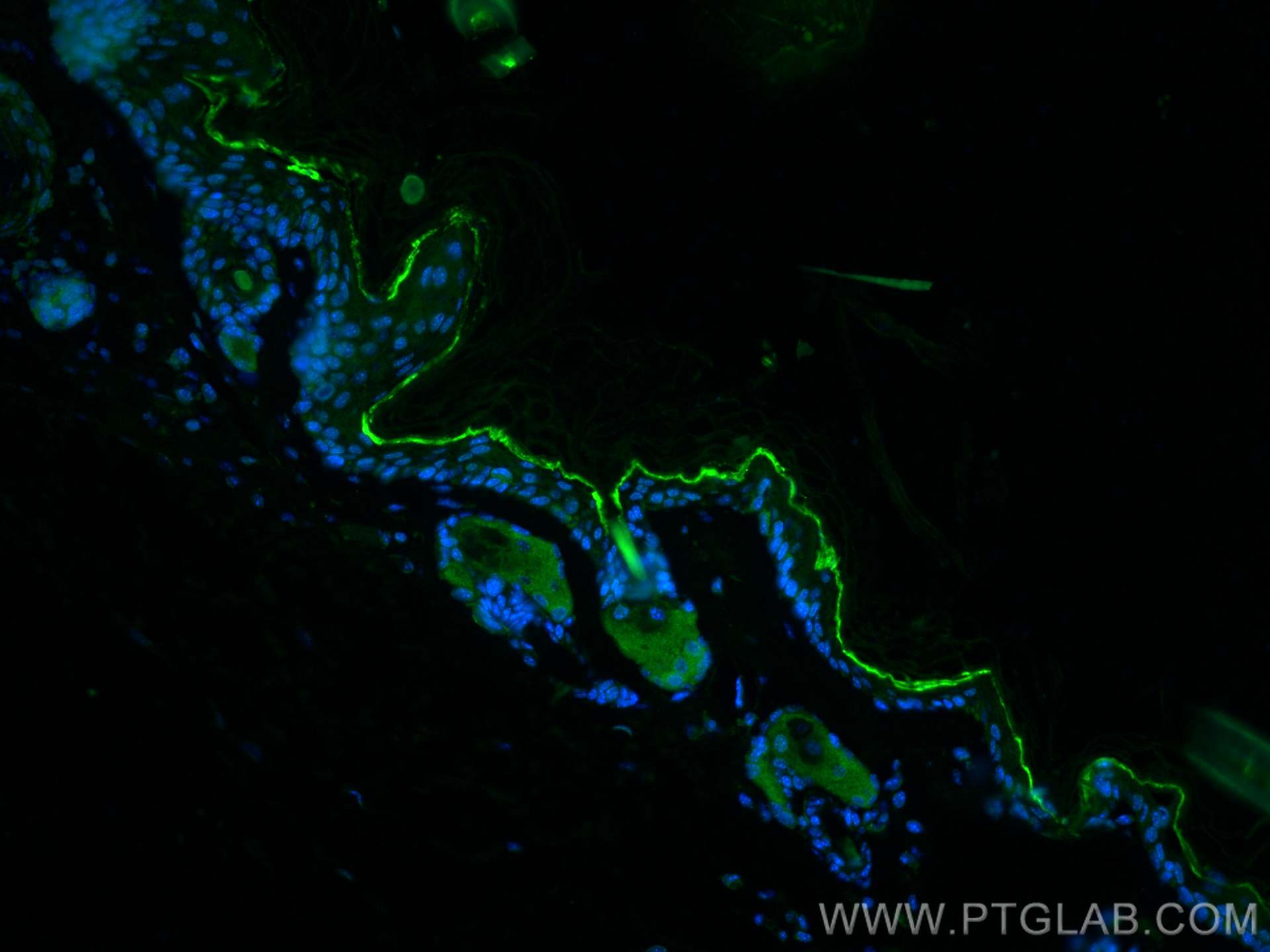 Immunofluorescence (IF) / fluorescent staining of mouse skin tissue using Collagen Type XVI Polyclonal antibody (19802-1-AP)