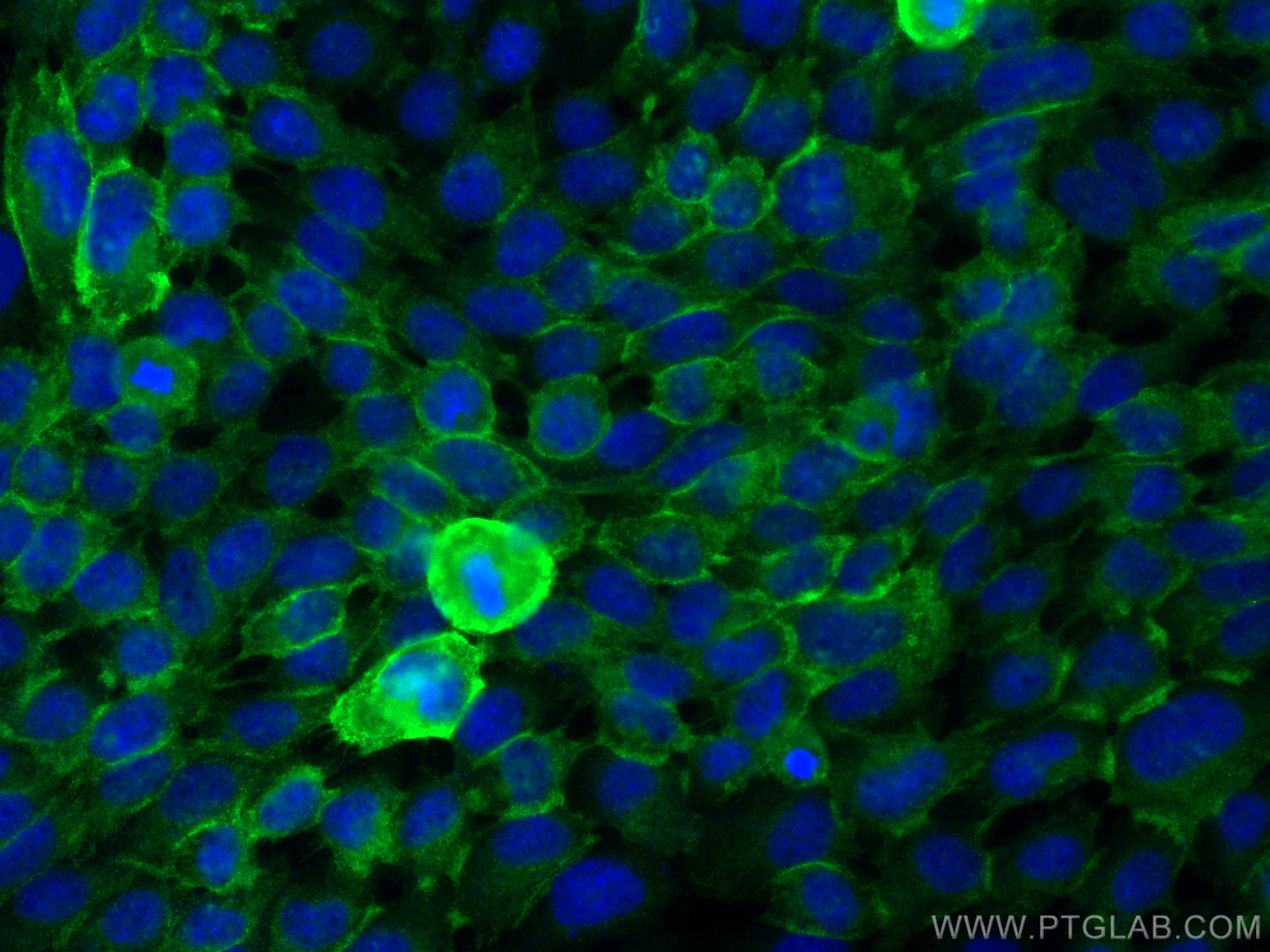 Immunofluorescence (IF) / fluorescent staining of A431 cells using COL17A1 Polyclonal antibody (31190-1-AP)