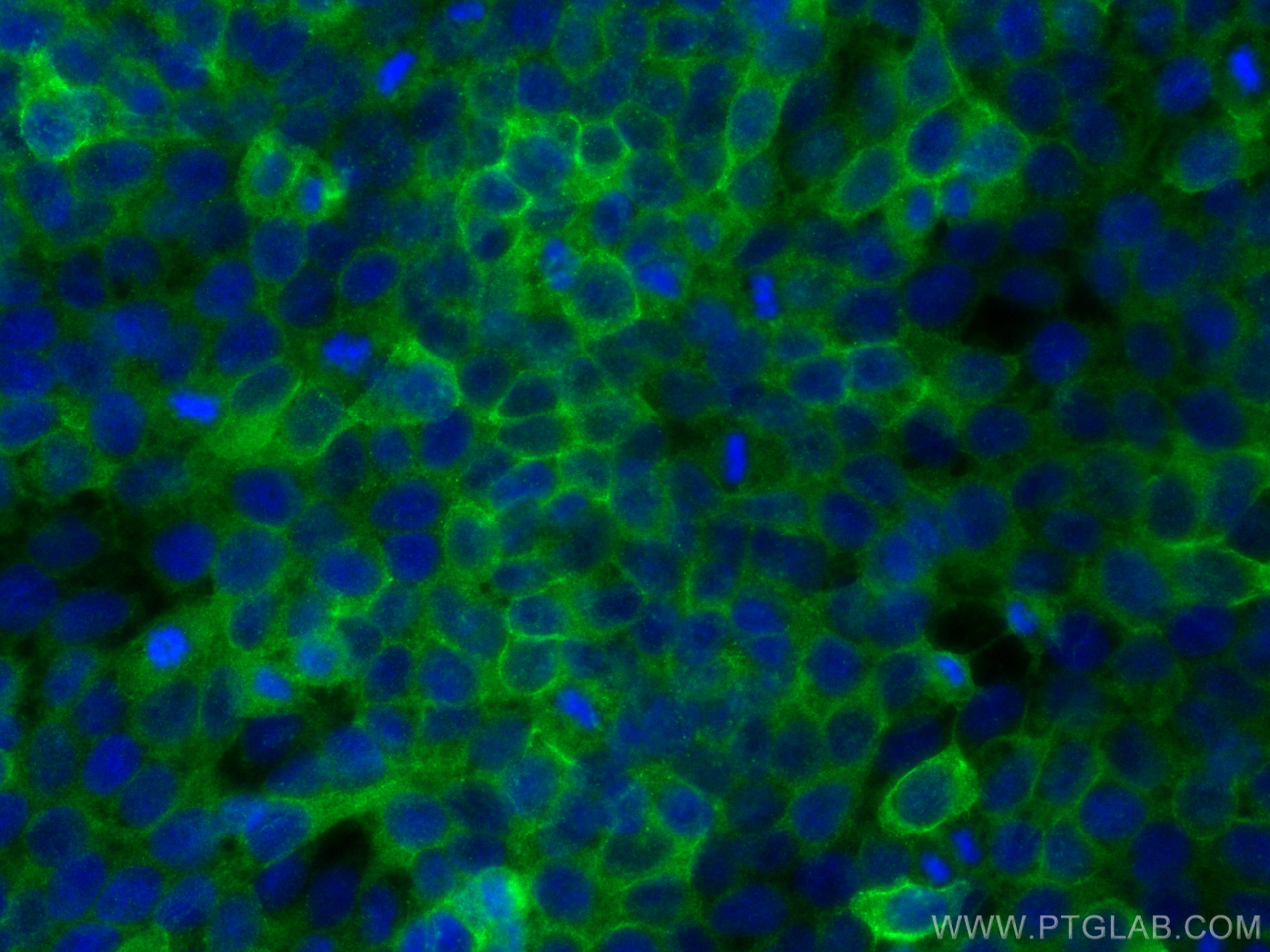 Immunofluorescence (IF) / fluorescent staining of HaCaT cells using COL17A1 Polyclonal antibody (31190-1-AP)