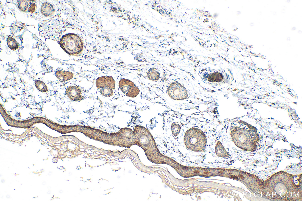 Immunohistochemistry (IHC) staining of rat skin tissue using COL17A1 Polyclonal antibody (31190-1-AP)