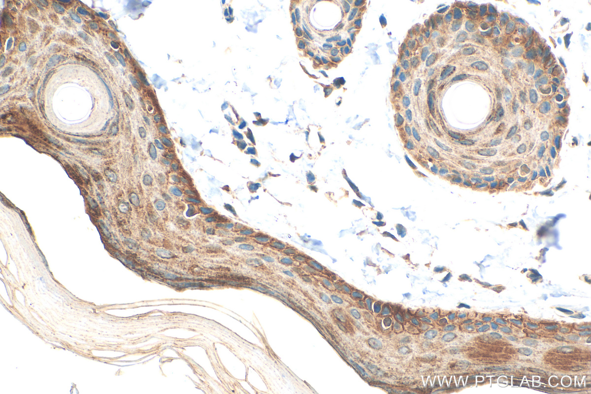 Immunohistochemistry (IHC) staining of rat skin tissue using COL17A1 Polyclonal antibody (31190-1-AP)