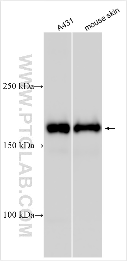 Western Blot (WB) analysis of various lysates using COL17A1 Polyclonal antibody (31190-1-AP)