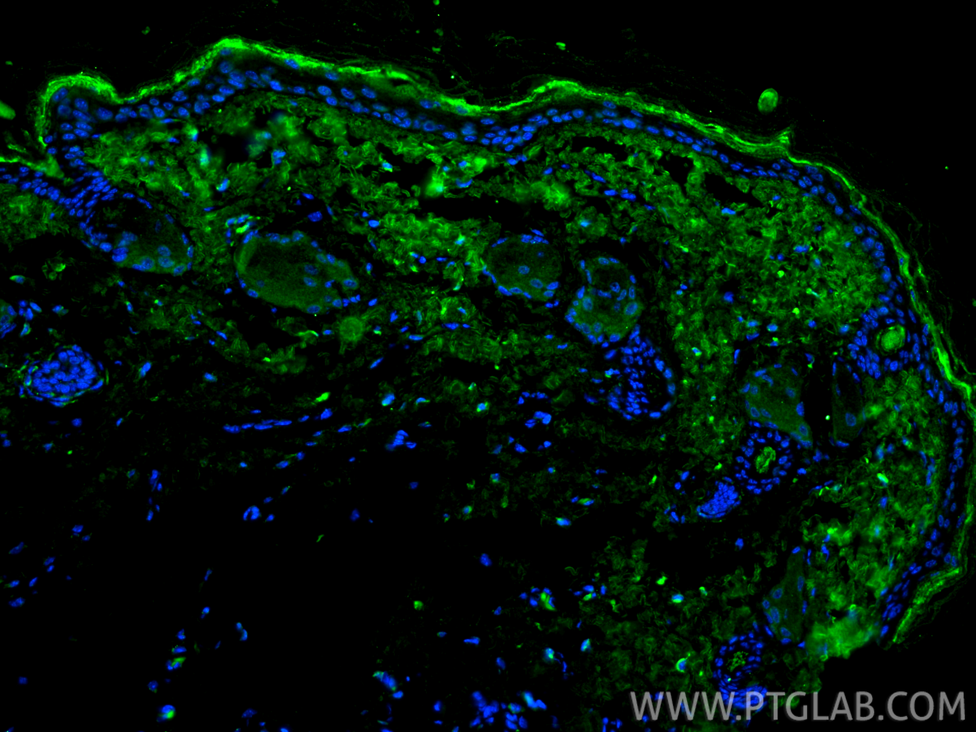 Immunofluorescence (IF) / fluorescent staining of mouse skin tissue using Collagen Type I Polyclonal antibody (14695-1-AP)