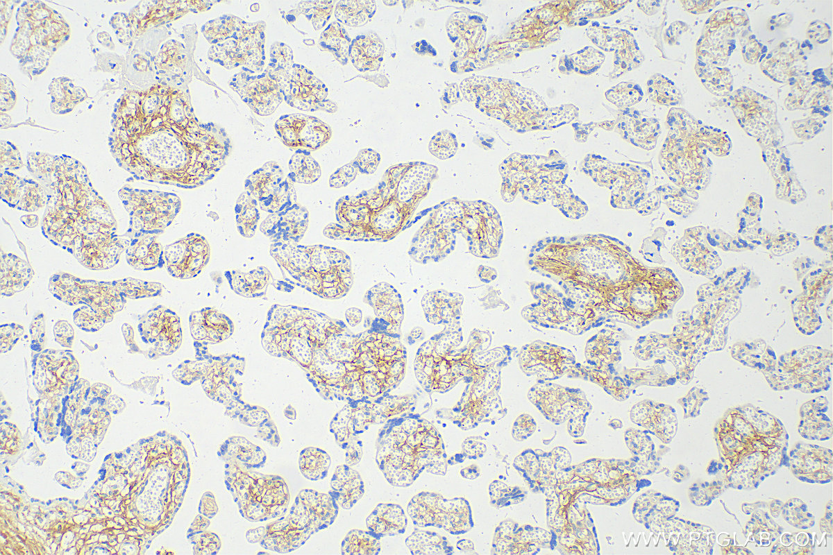 Immunohistochemistry (IHC) staining of human placenta tissue using Collagen Type I Polyclonal antibody (14695-1-AP)