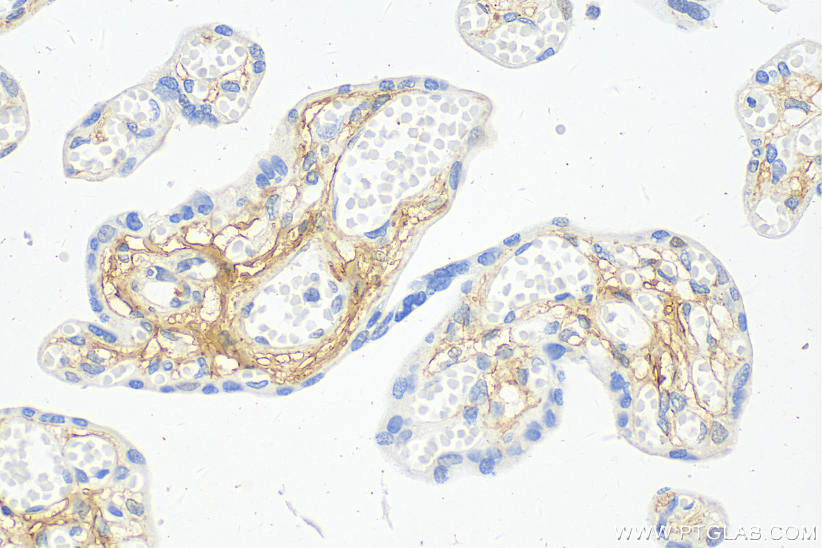 Immunohistochemistry (IHC) staining of human placenta tissue using Collagen Type I Polyclonal antibody (14695-1-AP)