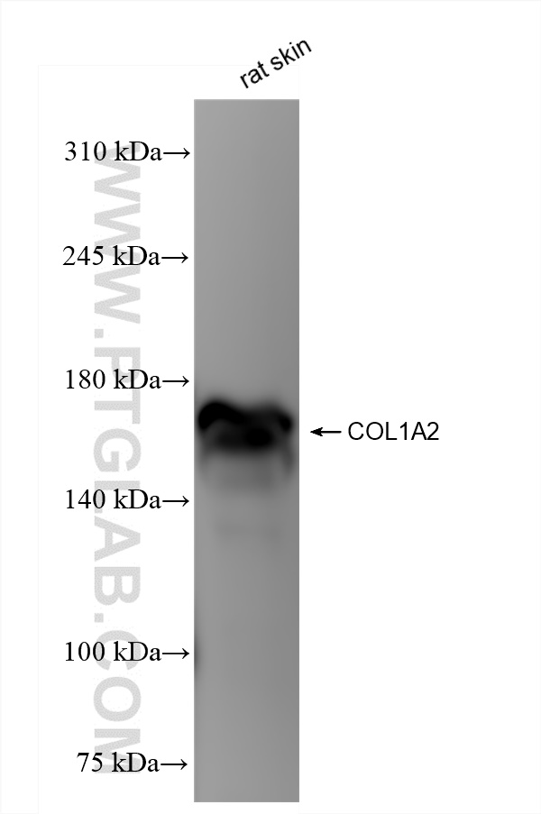 Collagen Type I