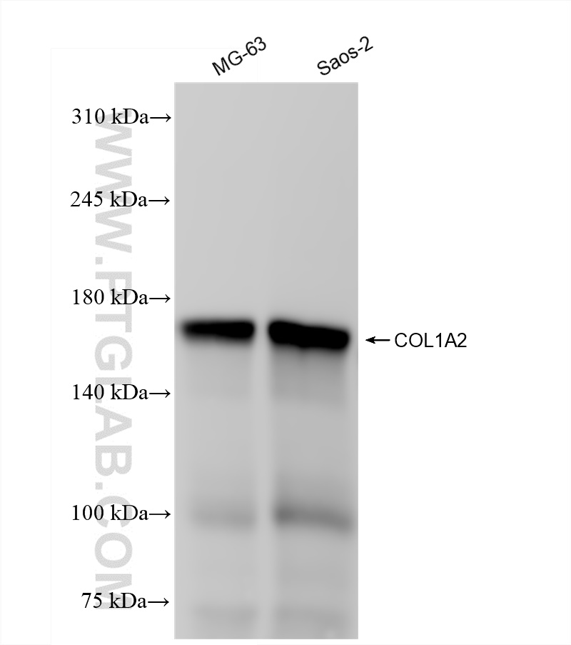 Western Blot (WB) analysis of various lysates using Collagen Type I Recombinant antibody (83752-3-RR)