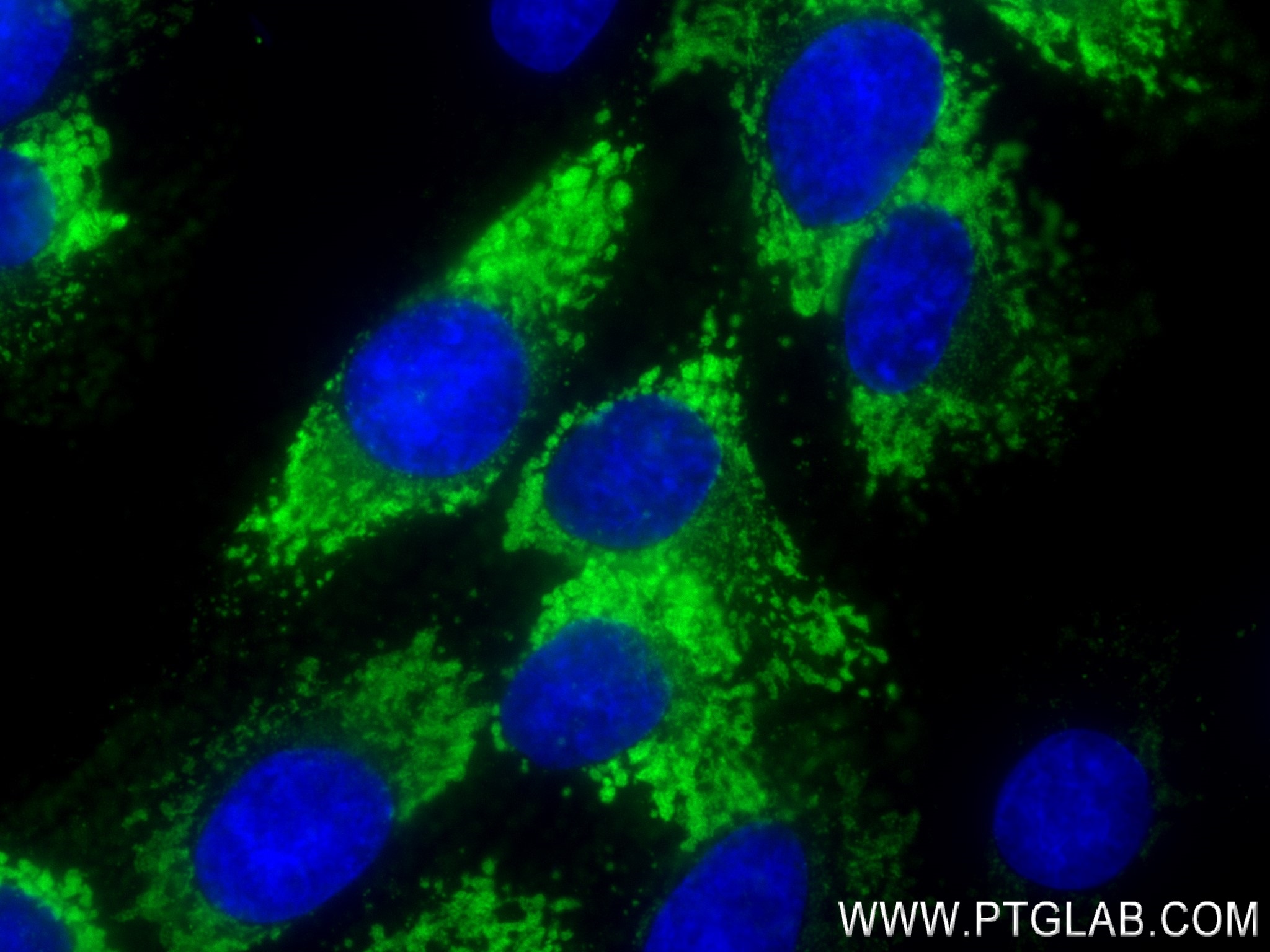 Immunofluorescence (IF) / fluorescent staining of HSC-T6 cells using Collagen Type I Recombinant antibody (83752-5-RR)