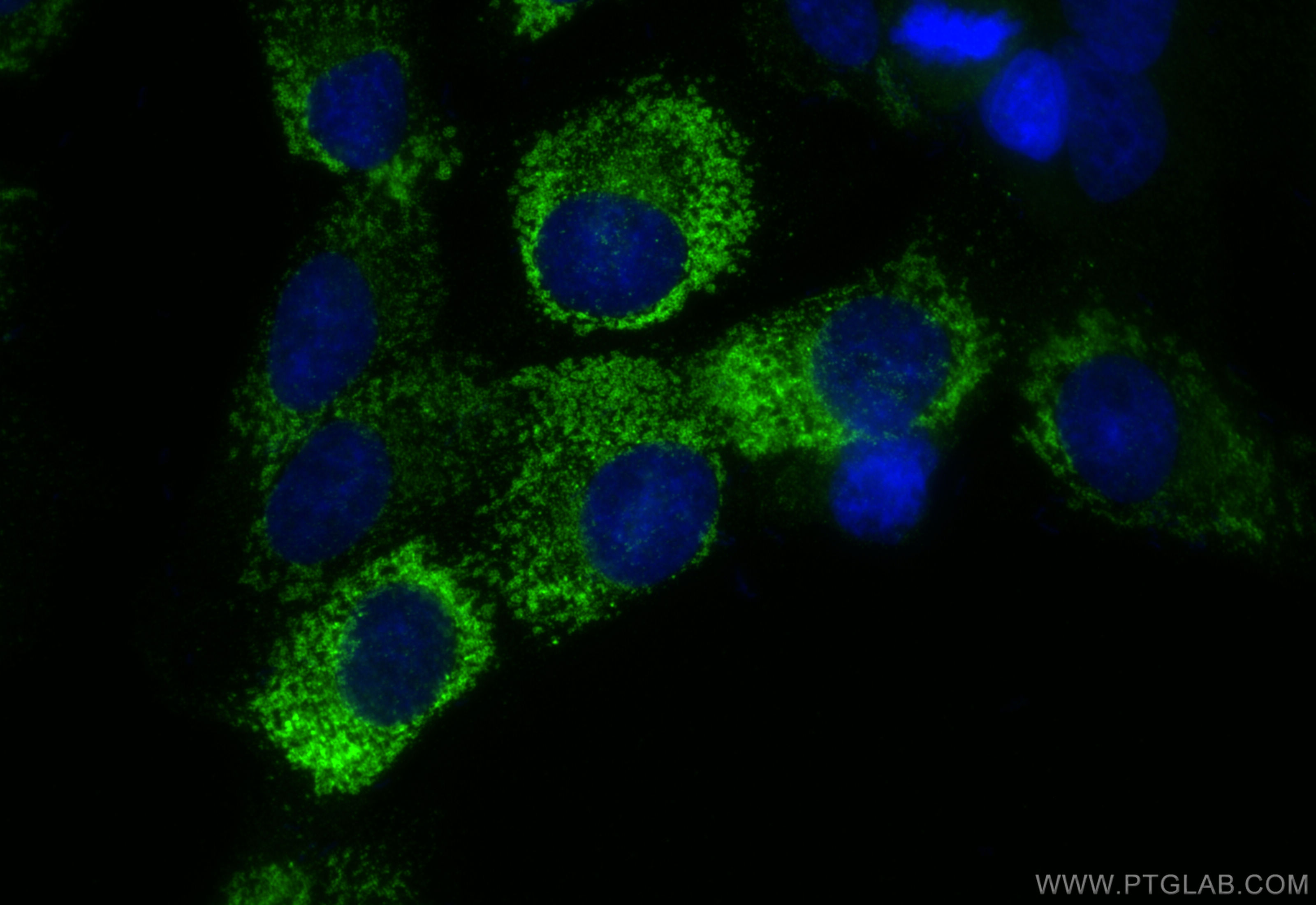 Immunofluorescence (IF) / fluorescent staining of HSC-T6 cells using Collagen Type I Recombinant antibody (83752-5-RR)