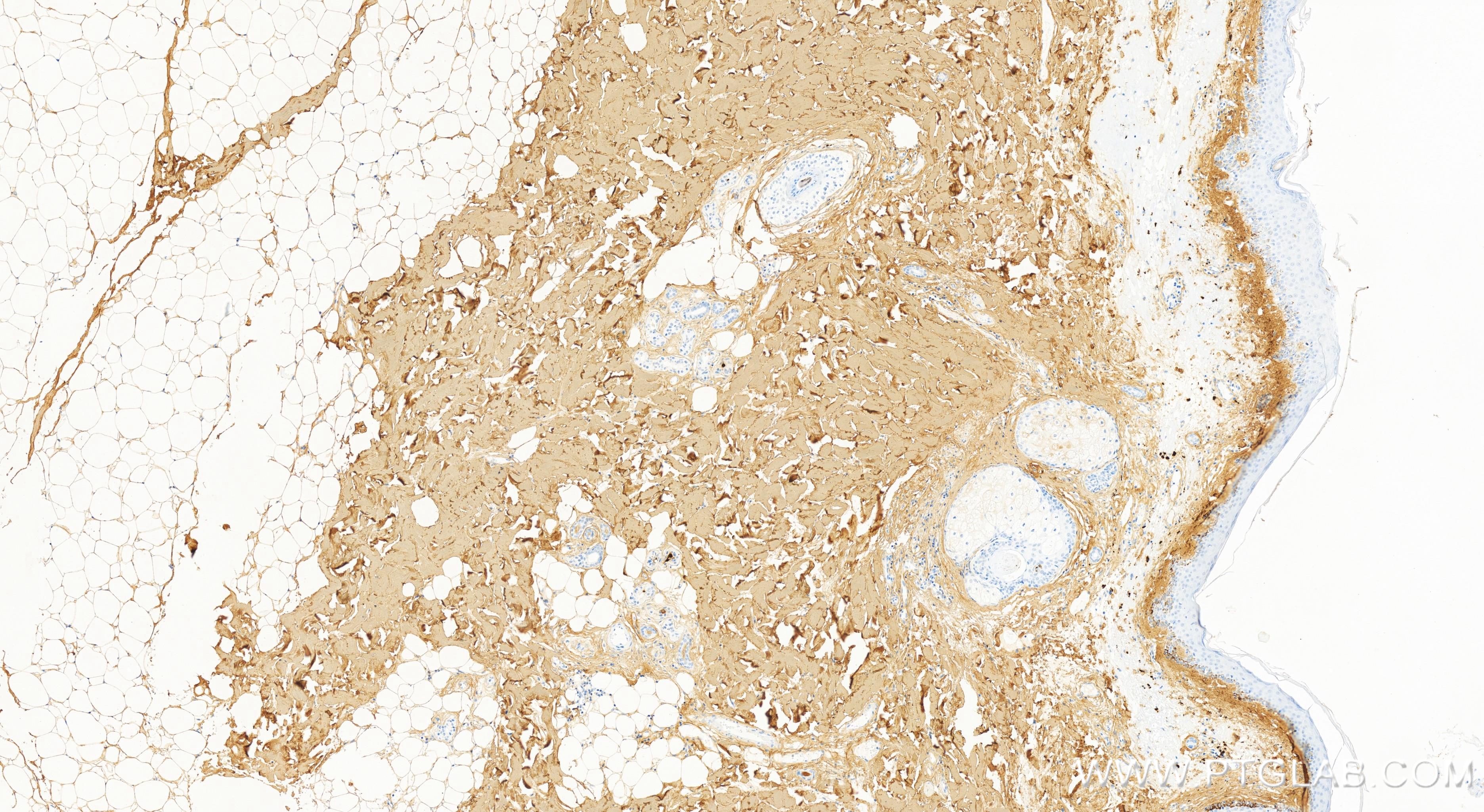 Immunohistochemistry (IHC) staining of human skin tissue using Collagen Type I Recombinant antibody (83752-5-RR)