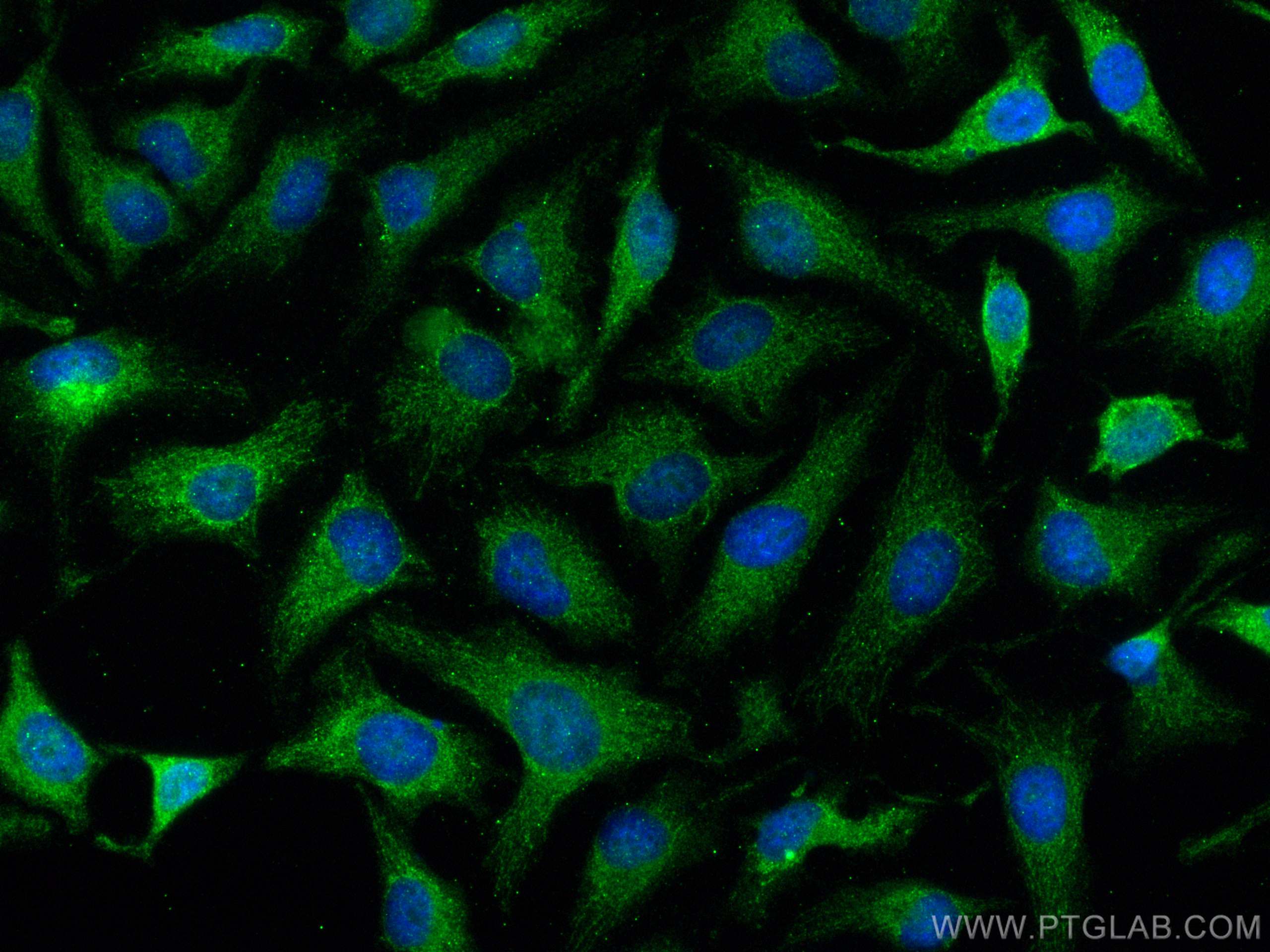 Immunofluorescence (IF) / fluorescent staining of HeLa cells using Collagen Type XXV Polyclonal antibody (12738-1-AP)