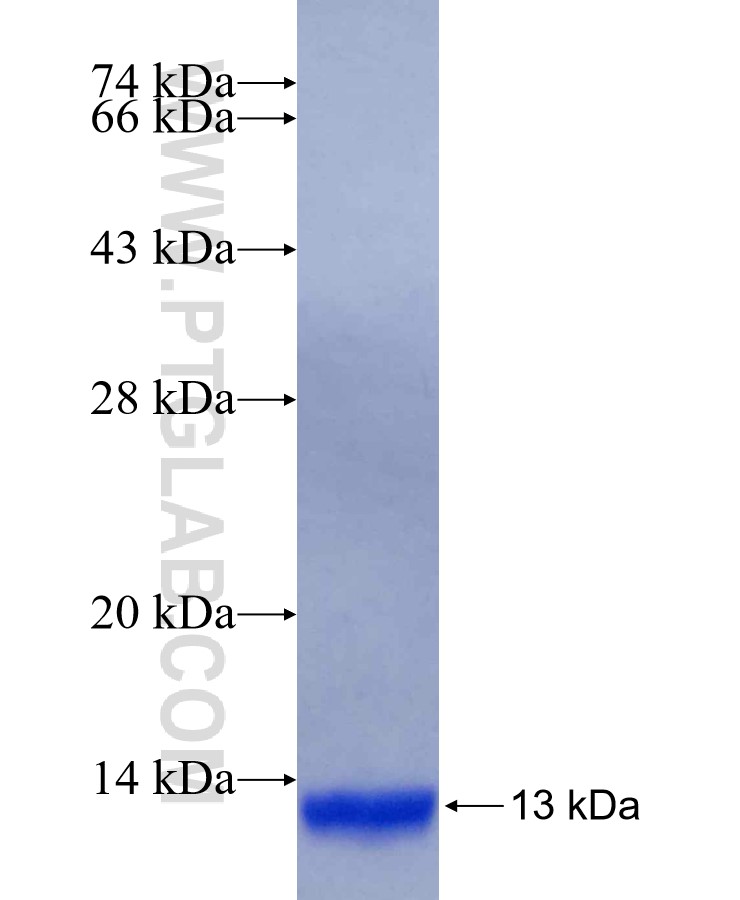 COL2A1 fusion protein Ag29295 SDS-PAGE