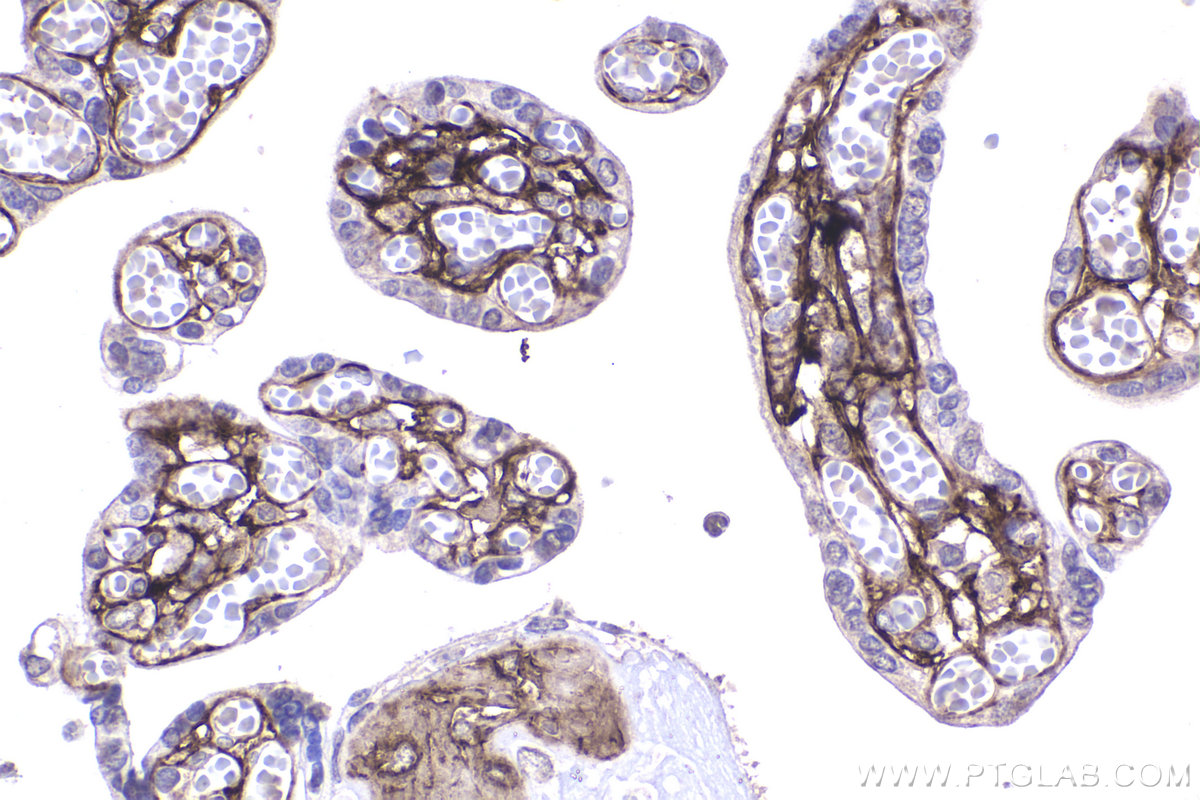 Immunohistochemistry (IHC) staining of human placenta tissue using COL3A1 Monoclonal antibody (68320-1-Ig)