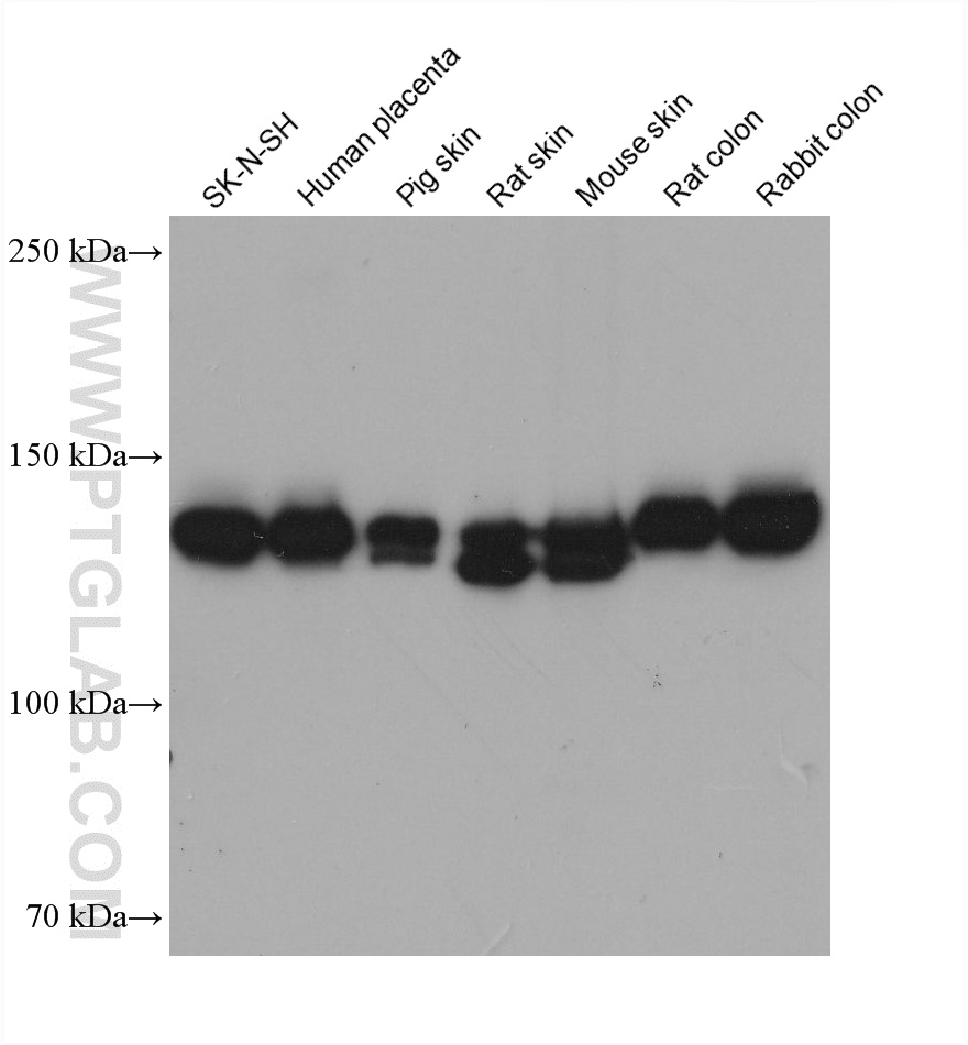Western Blot (WB) analysis of various lysates using Collagen Type III Monoclonal antibody (68320-1-Ig)