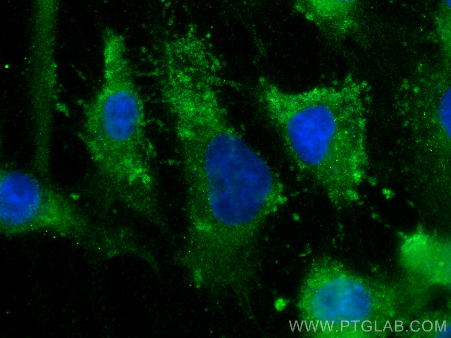 Immunofluorescence (IF) / fluorescent staining of HUVEC cells using COL5A3 Polyclonal antibody (30204-1-AP)