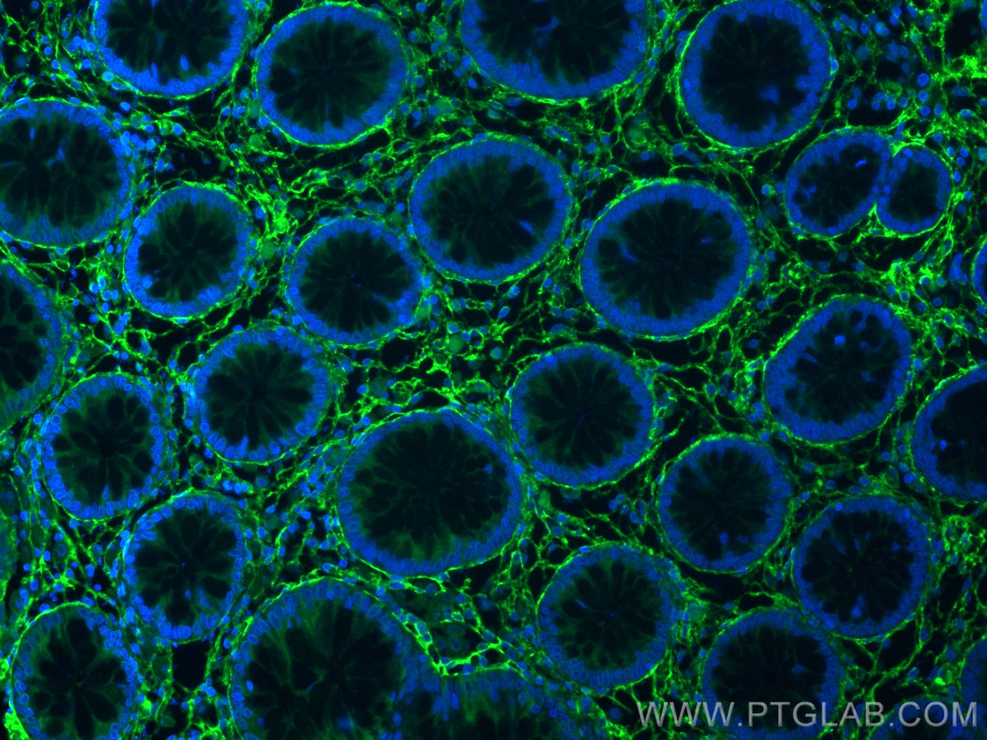 Immunofluorescence (IF) / fluorescent staining of human colon tissue using Collagen Type VI Polyclonal antibody (17023-1-AP)